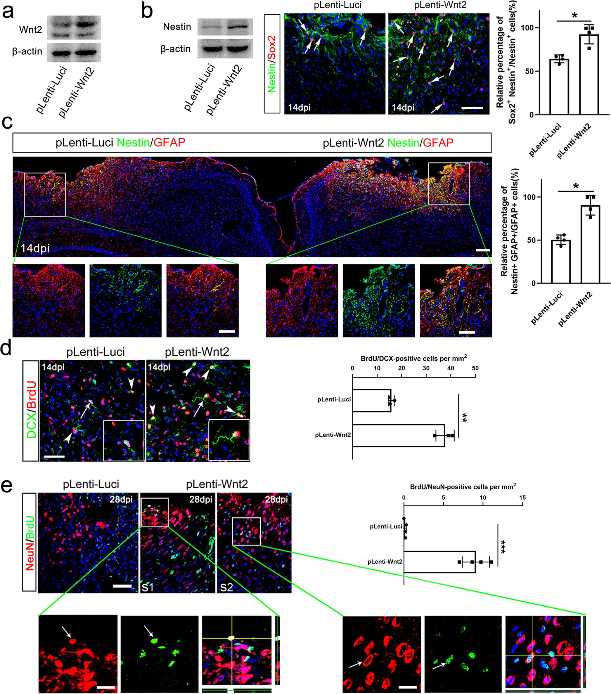 Fig. 4: Effects of Wnt2 over-expression on astrocyte dedifferentiation and cortical neurogenesis.