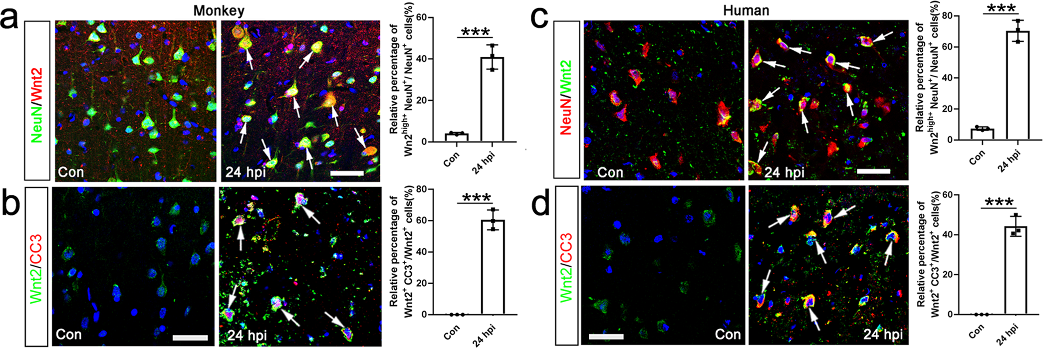 Fig. 8: Expression of Wnt2 in ischemic cortex of Macaca Mulatta and human cortex.