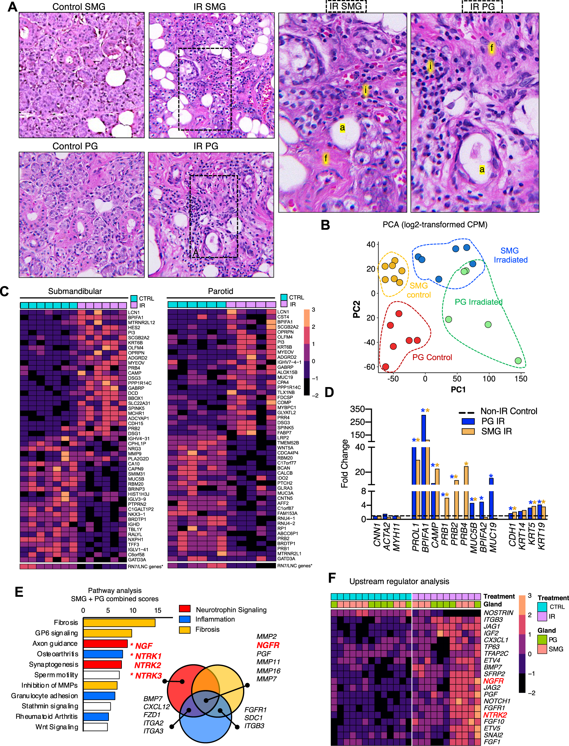 Fig. 1: Neurotrophin signaling is a key pathway dysregulated post-IR.