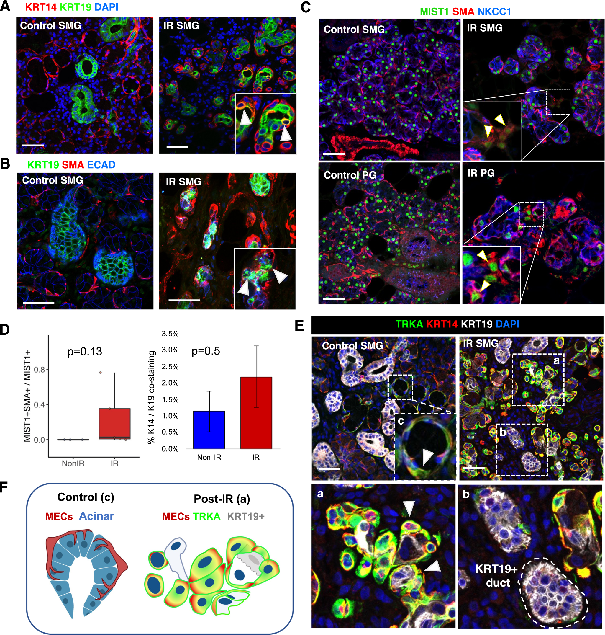 Fig. 7: Upregulation of NTRs is directly associated with abnormal morphology and co-expression of MIST1 and KRT19 in MECs post-IR in humans.