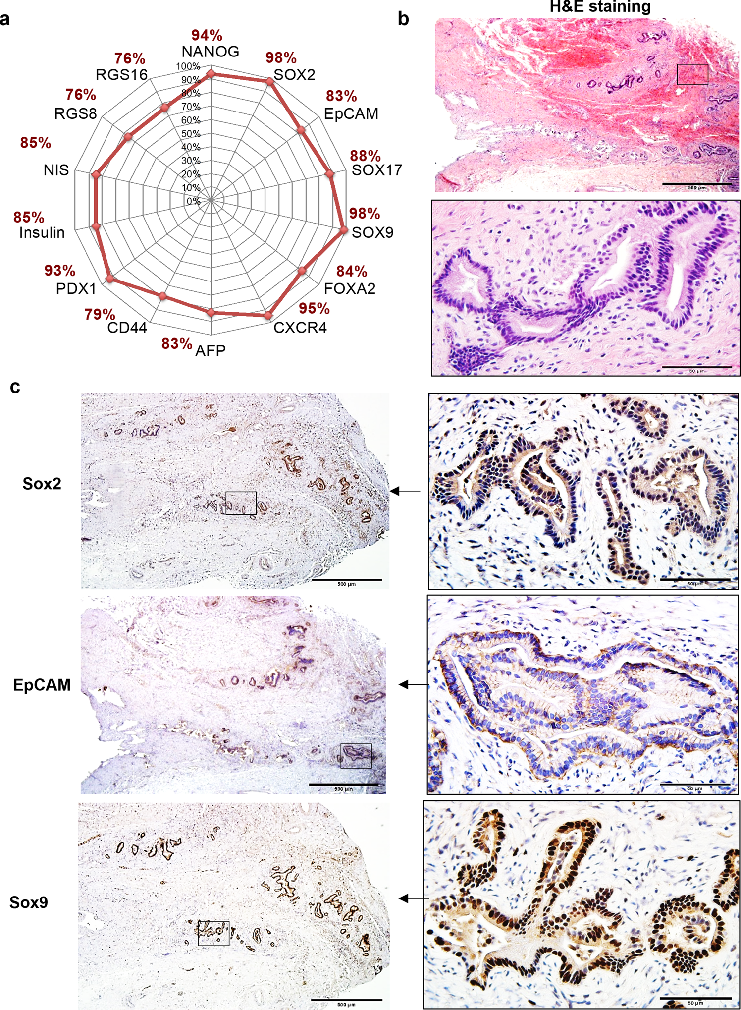 Fig. 4: Comparison of porcine niches to those in the human biliary tree (see also Table 1).