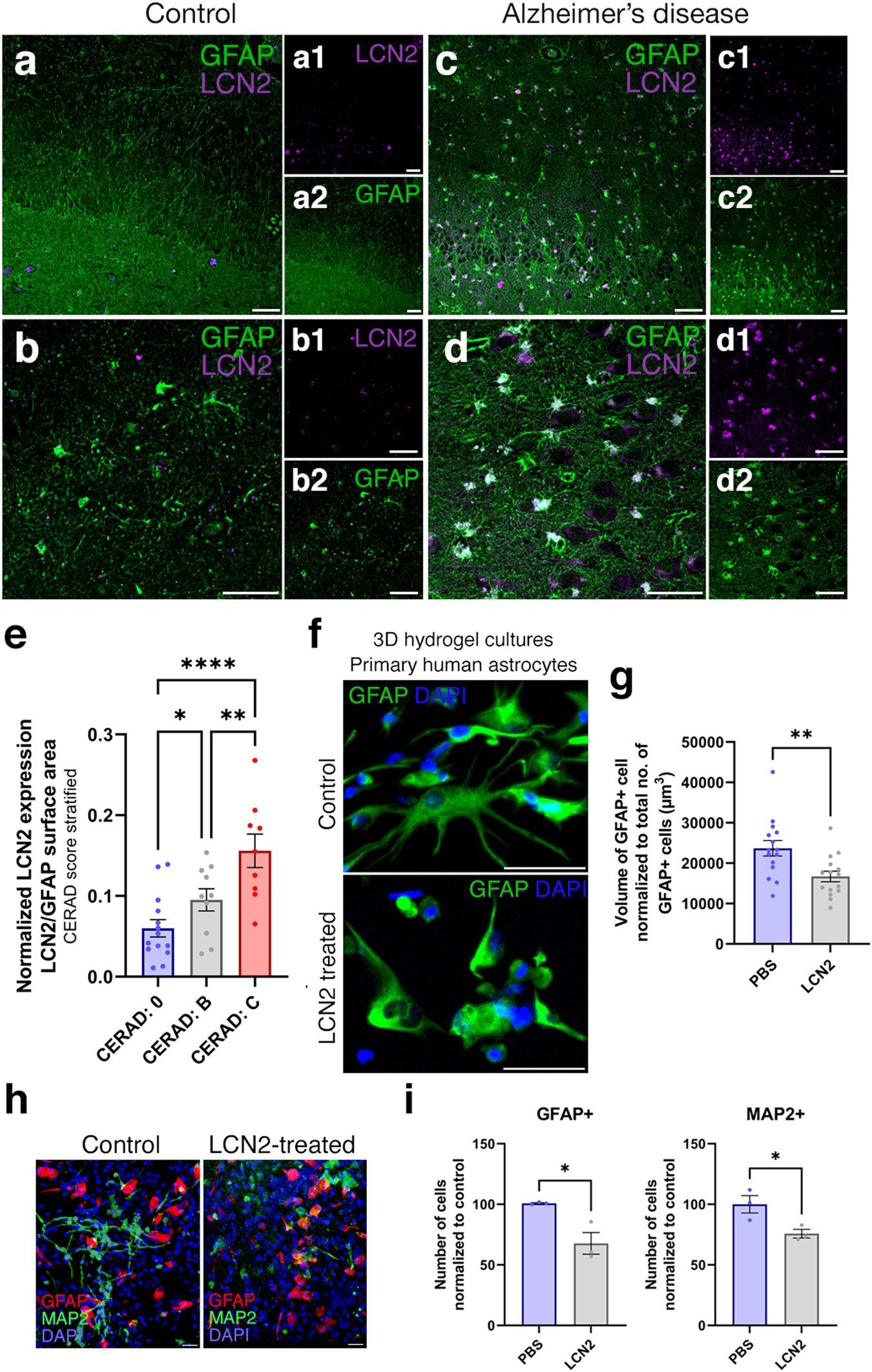 Fig. 6: LCN2 is upregulated in human brains with AD.