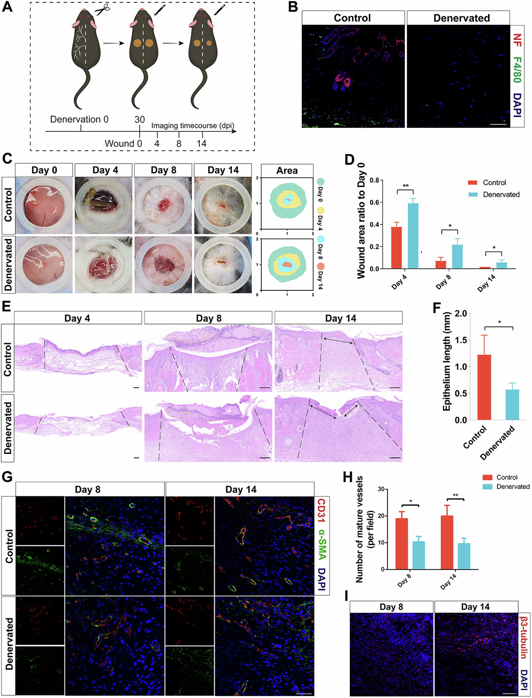 Fig. 2: Skin denervation impairs wound angiogenesis and re-epithelialization.