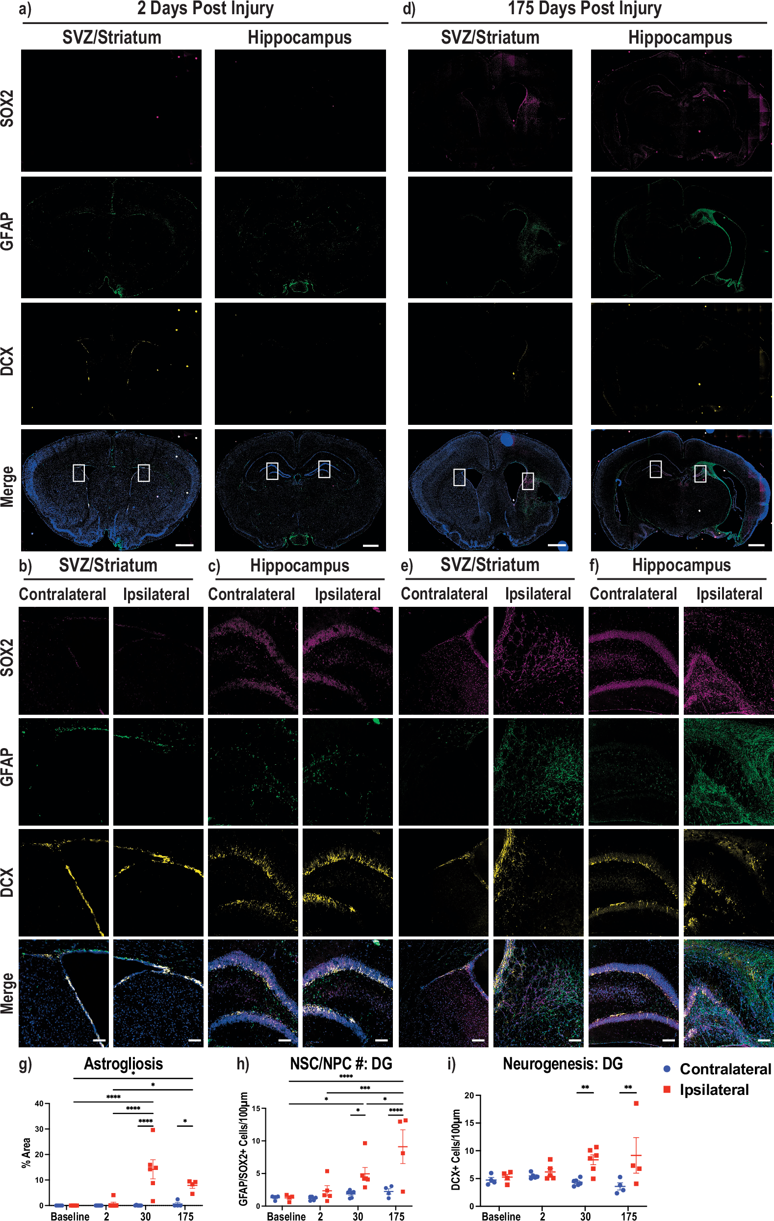Fig. 4: Glial scarring, neural stem cell, and neurogenesis post-stroke responses.