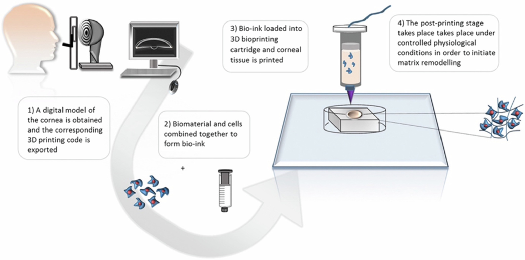 Fig. 10: Model of 3D-bioprinting for engineering of artificial corneal structures (From: Isaacson A, Swioklo S, Connon CJ.