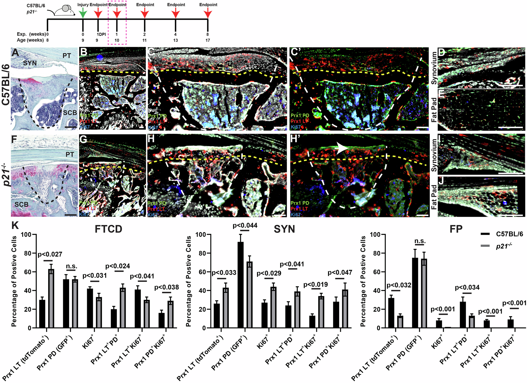 Fig. 3: Prx1+ MPCs in mouse knee joints at 1 WPI.