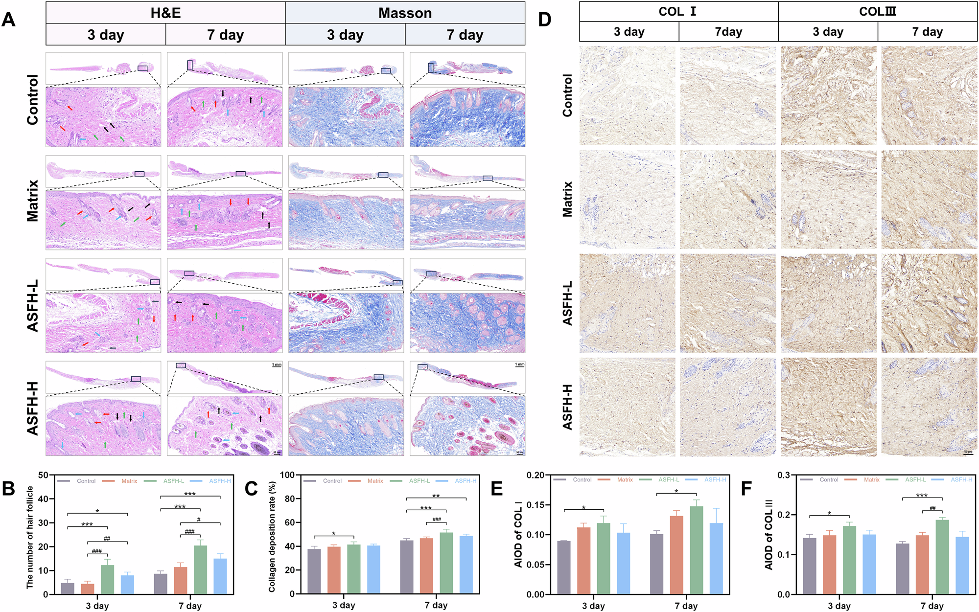 Fig. 7: Histological evaluation of re-epithelialization and collagen remodeling.