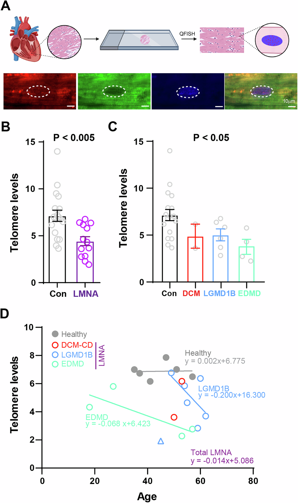 Fig. 1: Cardiomyocytes from patients suffering laminopathies exhibit shortened telomeres.