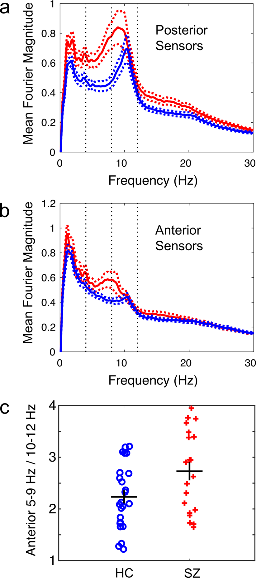 A Multimodal Magnetoencephalography 7 T Fmri And 7 T Proton Mr Spectroscopy Study In First Episode Psychosis Npj Schizophrenia