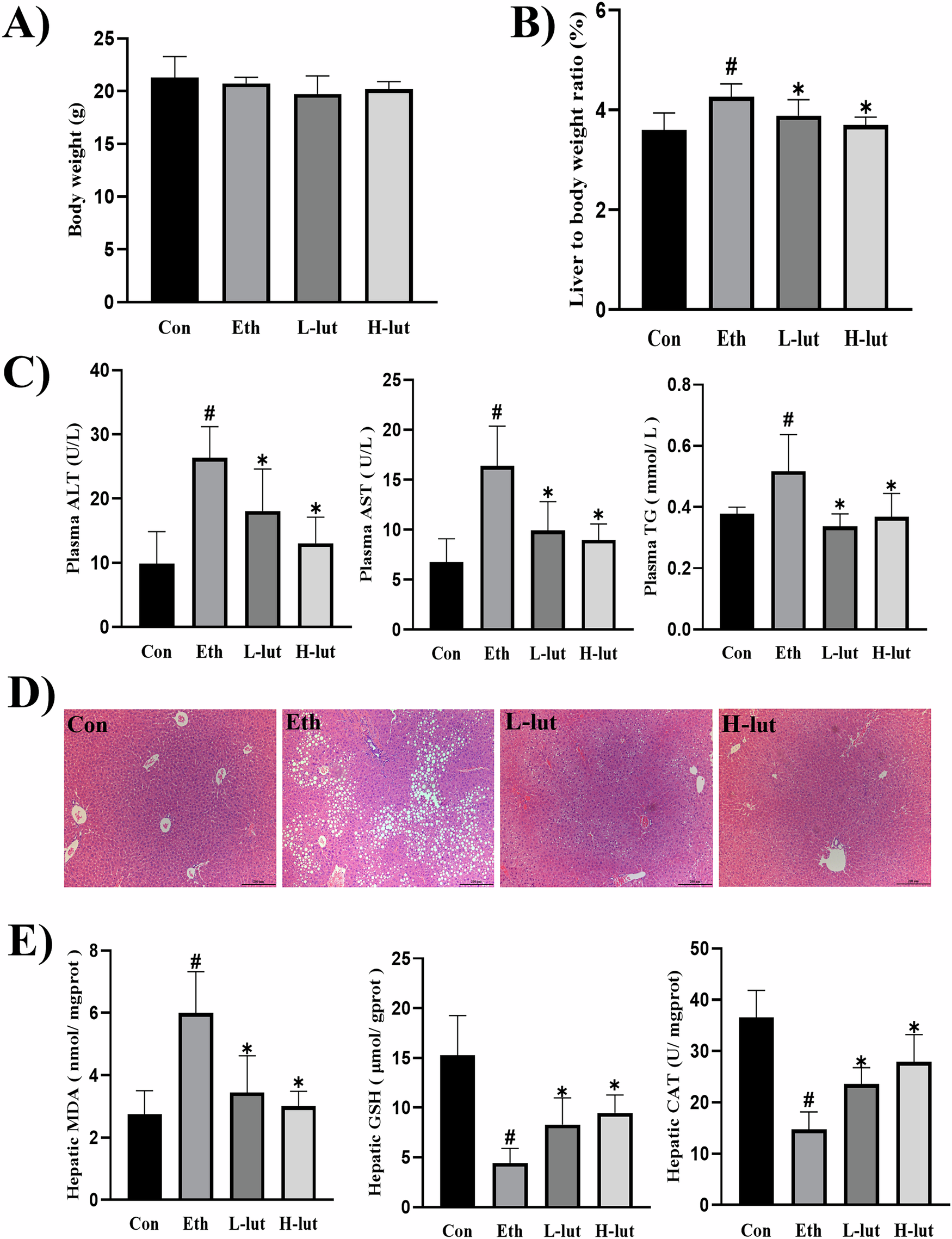 Fig. 1: Luteolin reduces ethanol-induced hepatic steatosis and improves metabolic dysfunction.