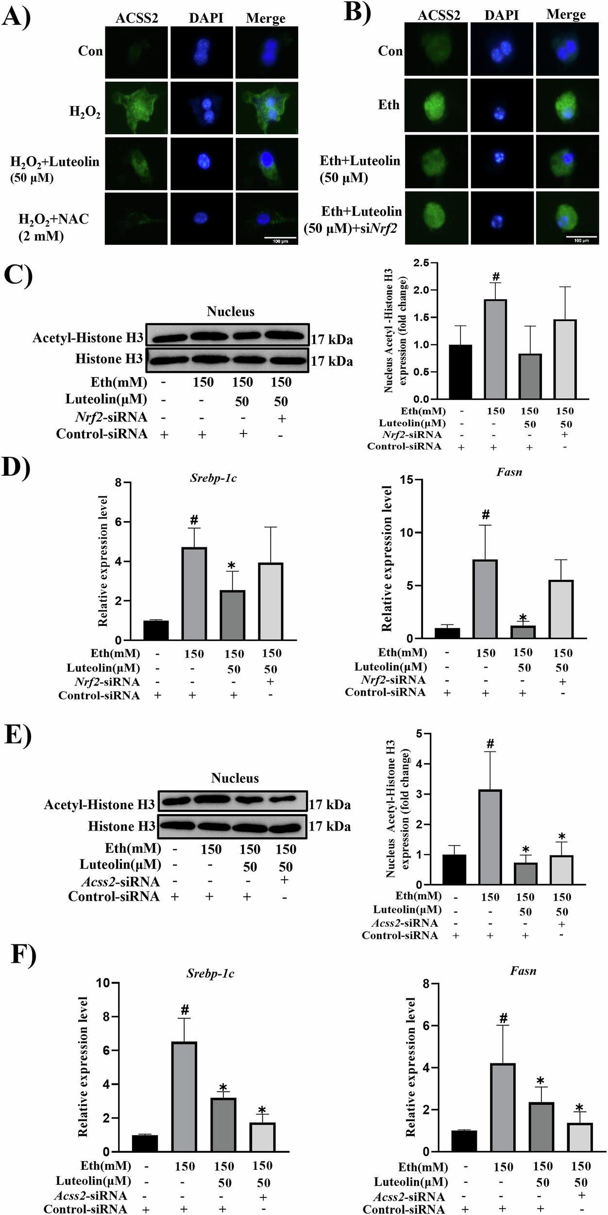 Fig. 4: NRF2 is involved in the nuclear accumulation of ACSS2.