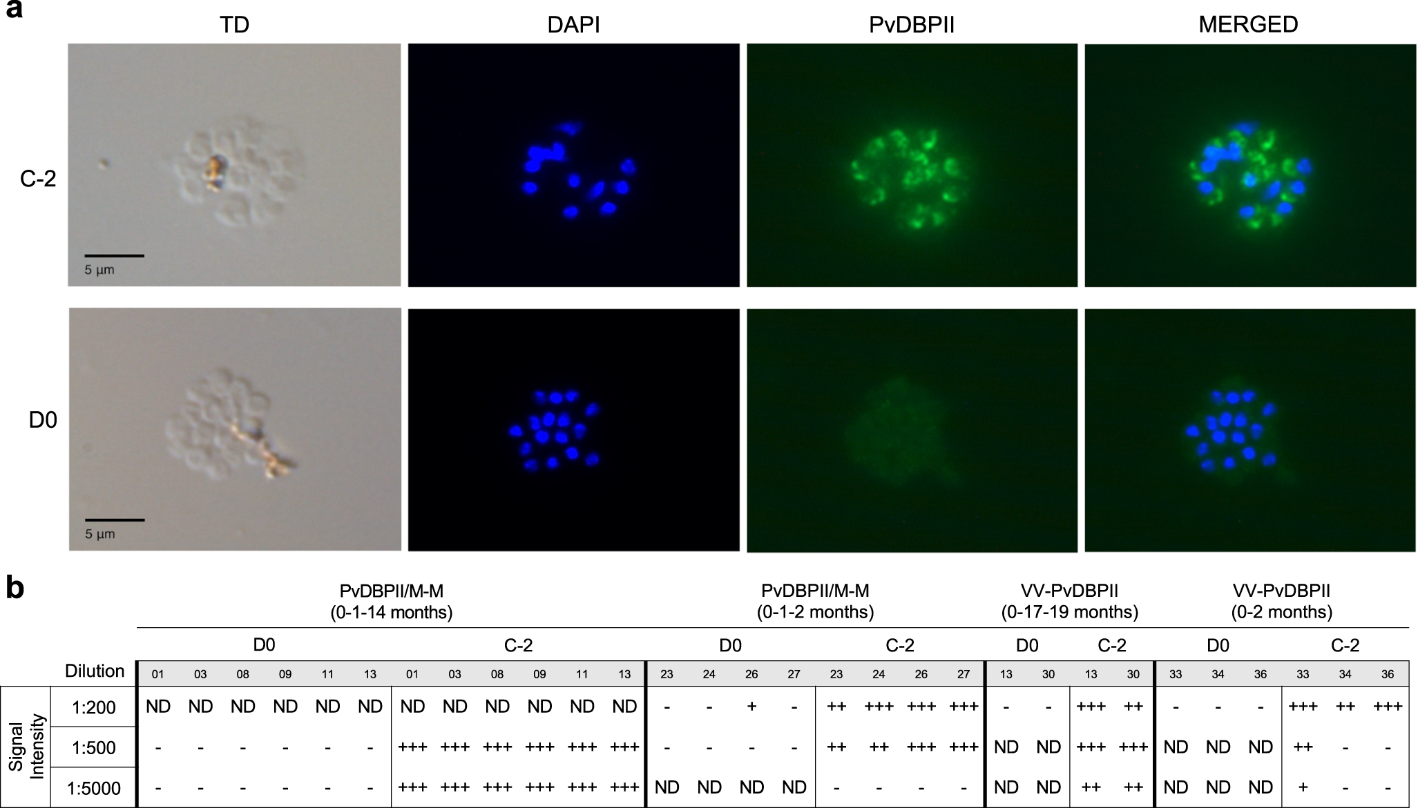 Fig. 2: Reactivity of sera from immunized volunteers with P. vivax schizonts.