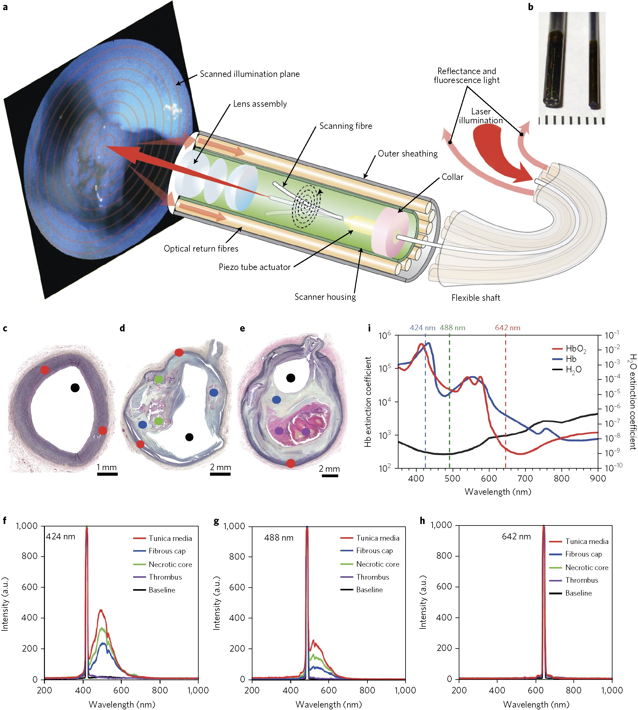 Multimodal laser-based angioscopy for structural, chemical and biological  imaging of atherosclerosis | Nature Biomedical Engineering