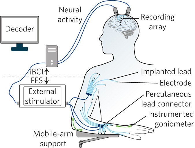 Image source: Nature Biomedical Engineering, A biointegrated and wireless anatomically conformal electronic system for spinal cord neuromodulation