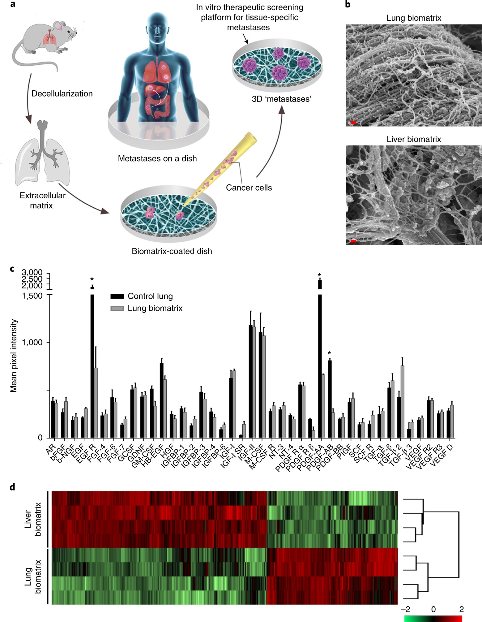 Organ specific metastases obtained by culturing colorectal cancer