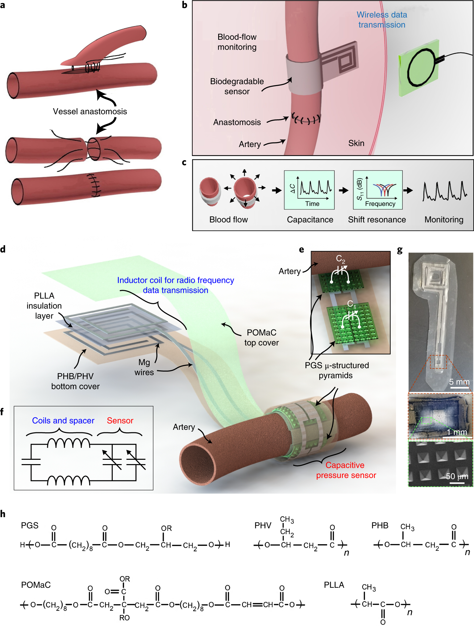 Experimental Biodegradable Traffic >> Biodegradable And Flexible Arterial Pulse Sensor For The Wireless Experimental Biodegradable Traffic >> Biodegradable And Flexible Arterial Pulse Sensor For The Wireless
