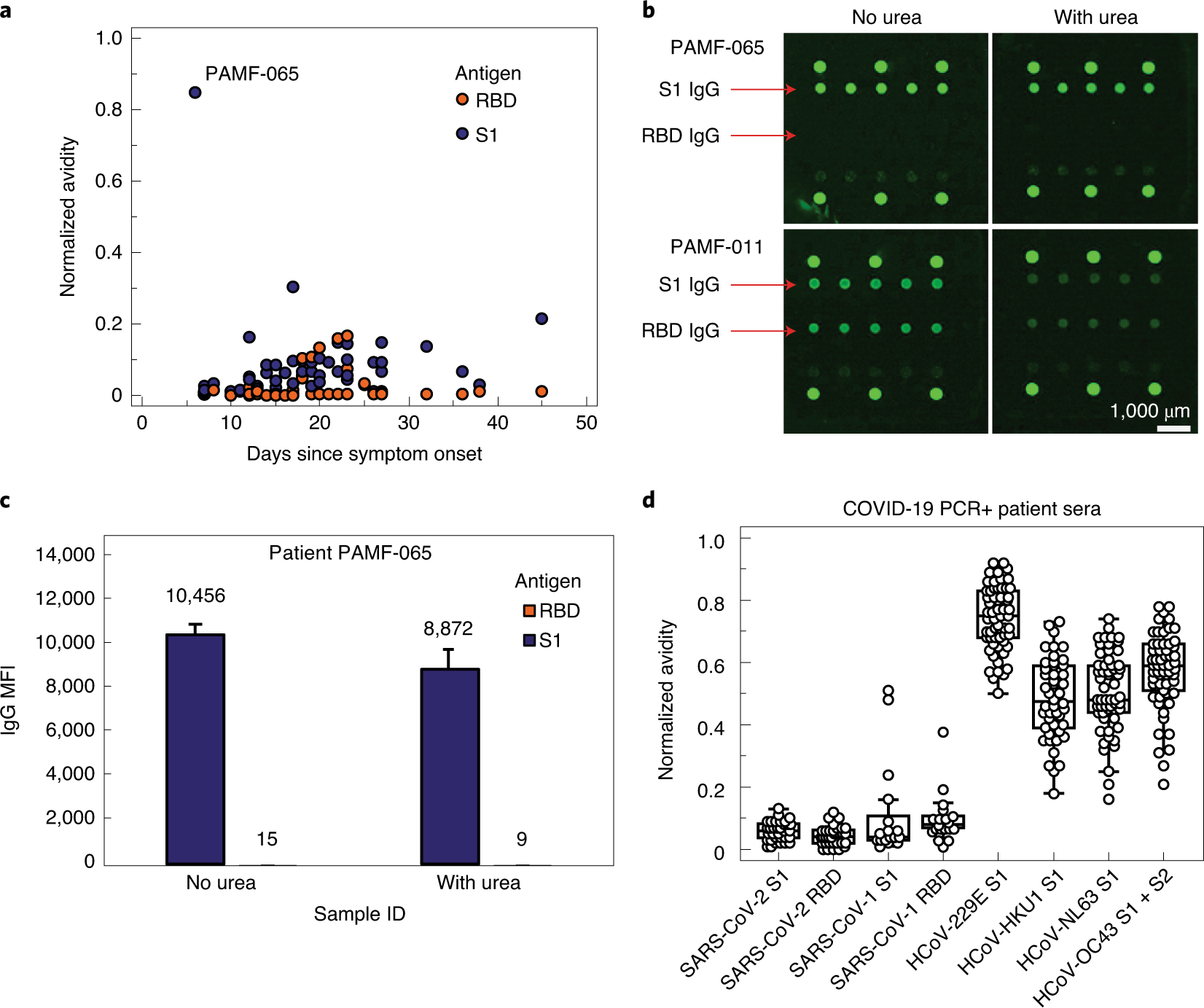Fig. 4: Antibody avidity against novel and previous coronaviruses.