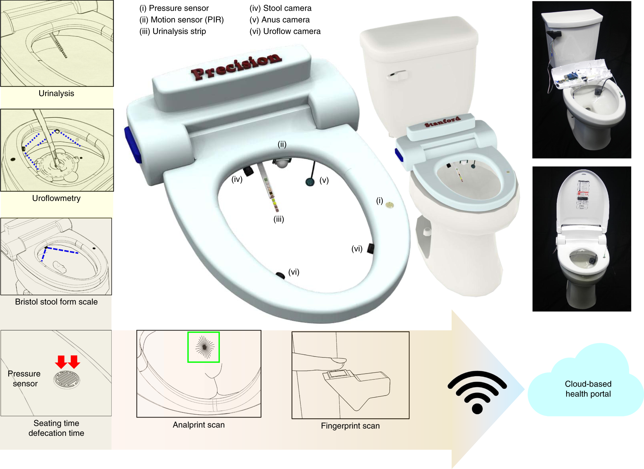 A mountable toilet system for personalized health monitoring via the  analysis of excreta | Nature Biomedical Engineering