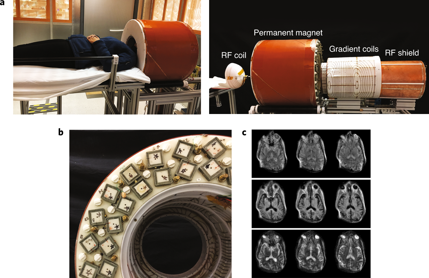 Compact Brain Mri Nature Biomedical Engineering