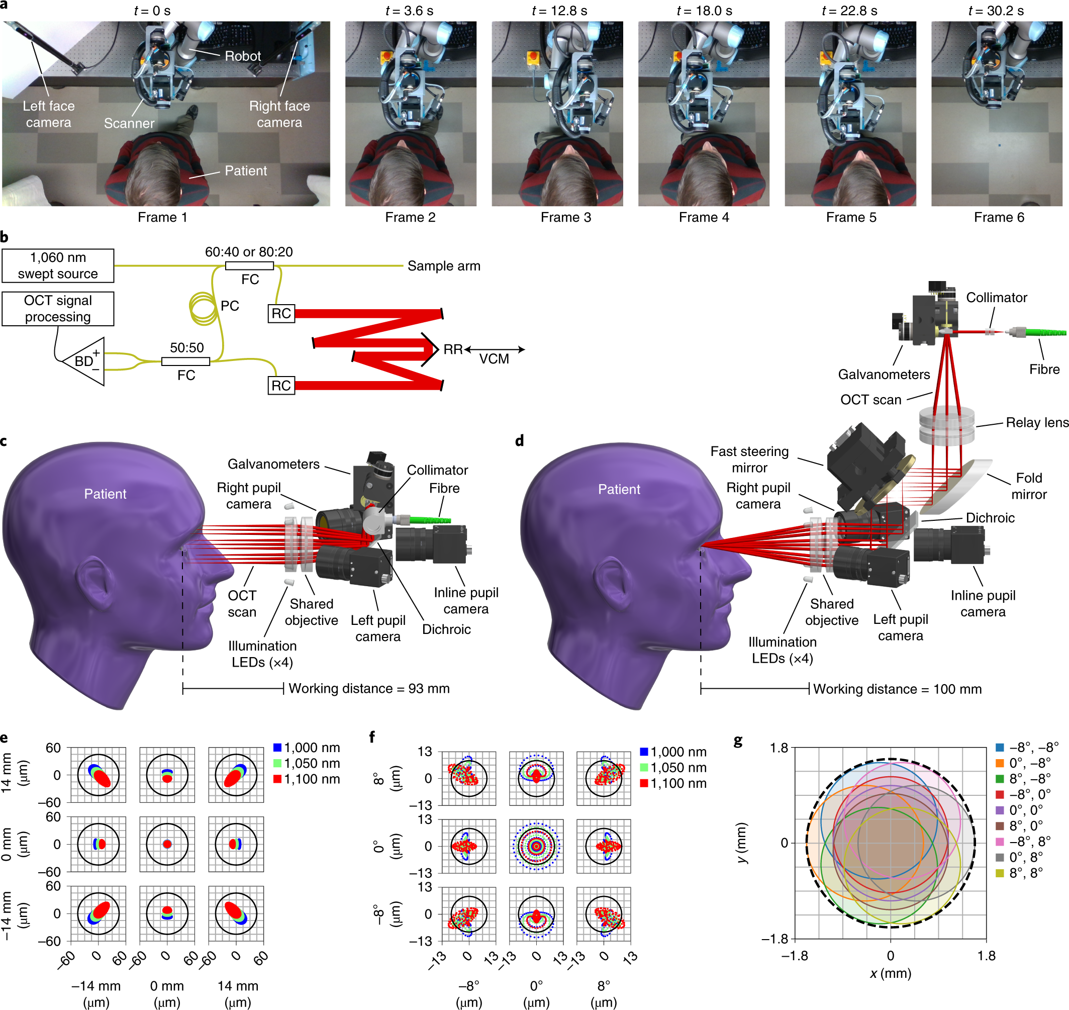 Contactless optical coherence tomography of the eyes of