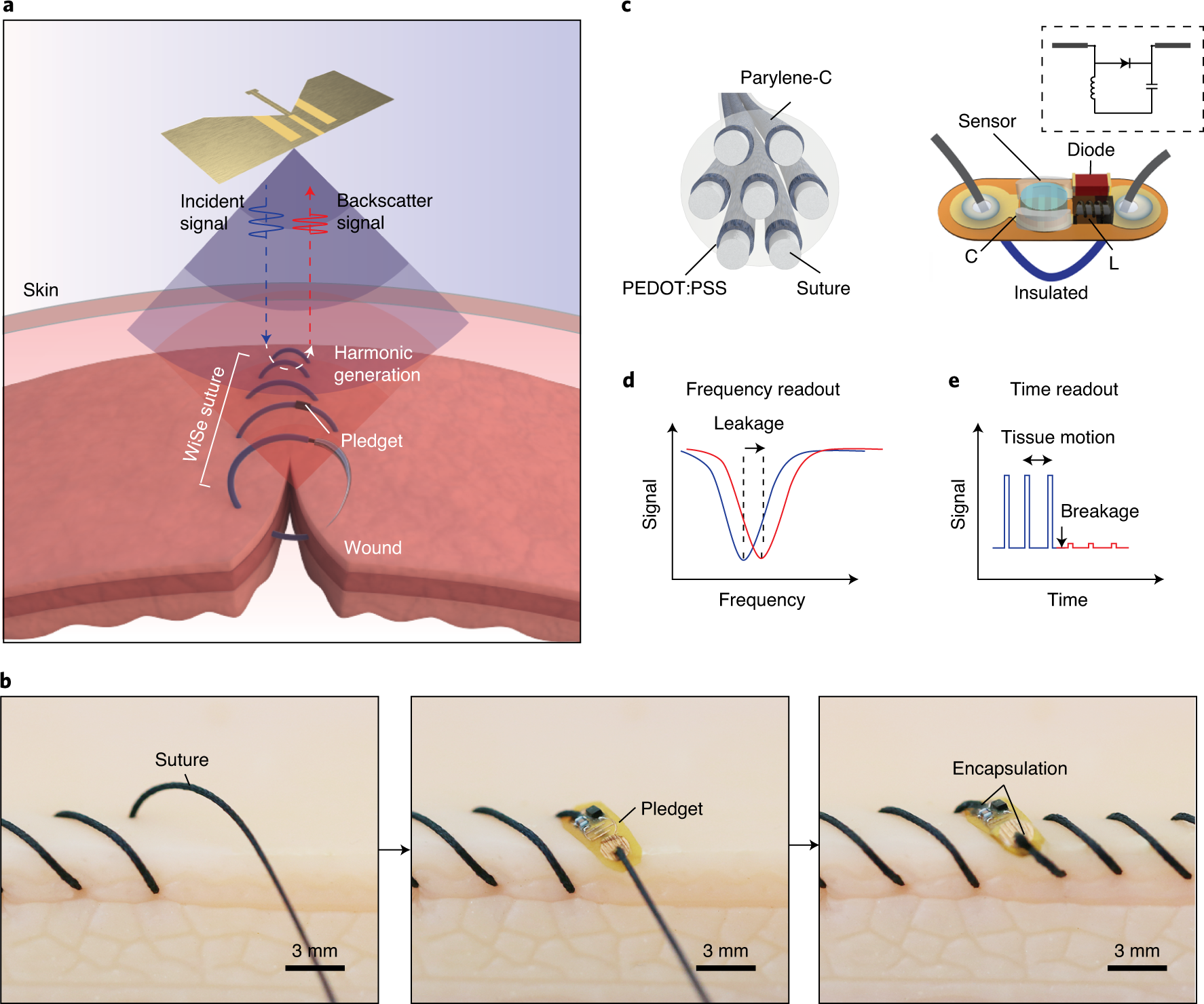 Skin glue (sutureless) closure of surgical incisions