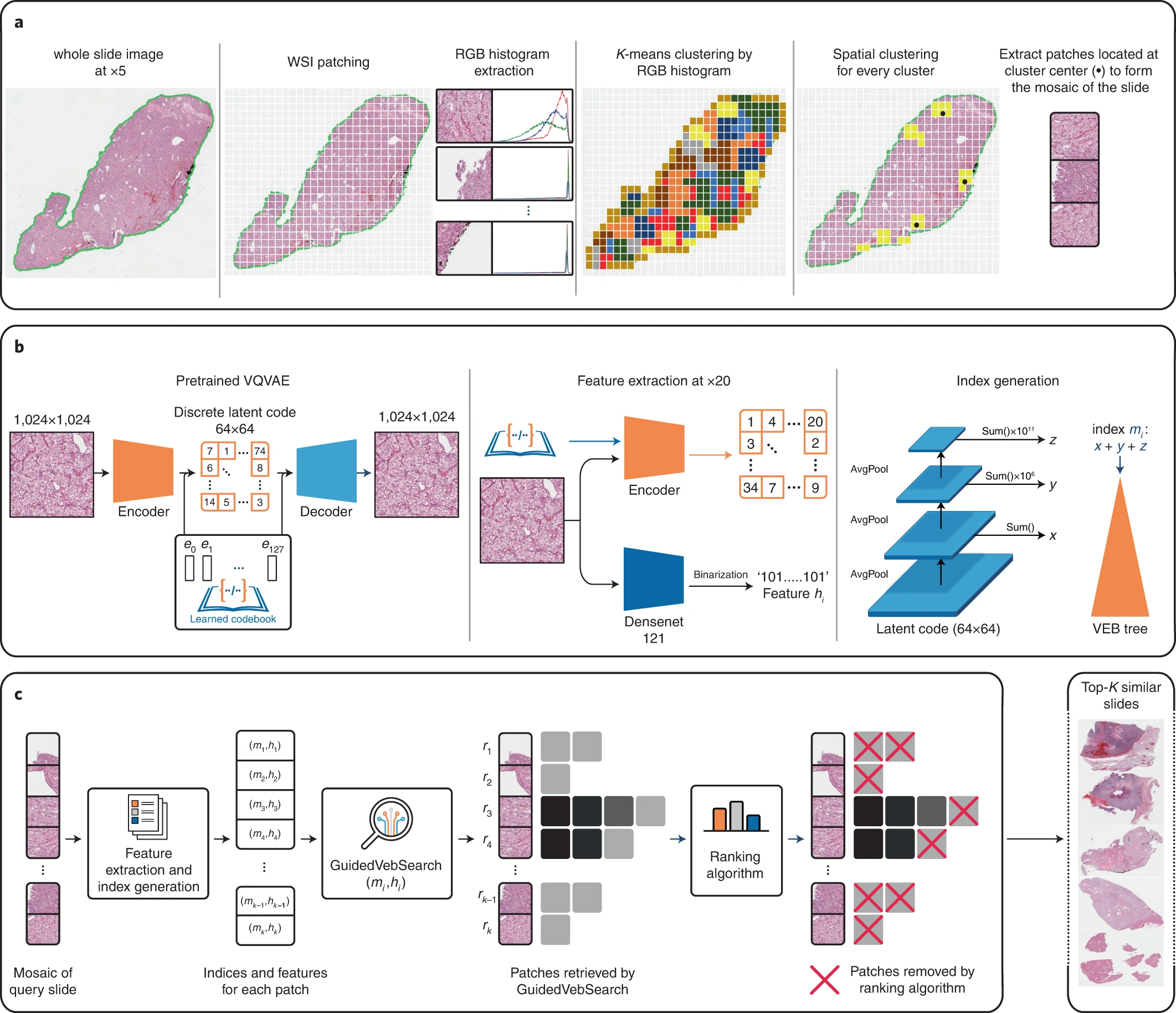 Self-Teaching AI Uses Pathology Images to Find Similar Cases, Diagnose Rare Diseases