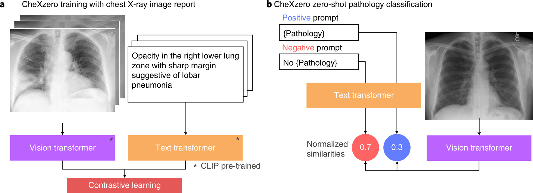 1773px x 641px - Expert-level detection of pathologies from unannotated chest X-ray images  via self-supervised learning | Nature Biomedical Engineering