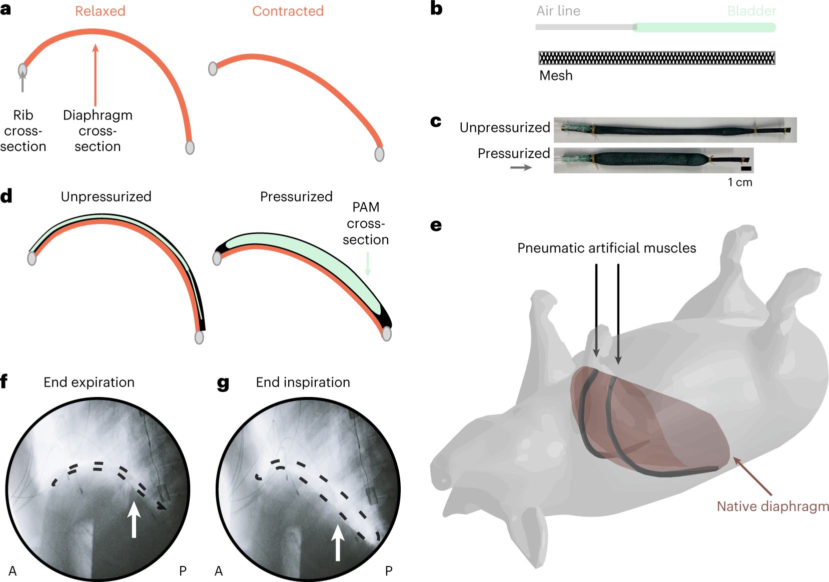 An implantable soft robotic ventilator augments inspiration in a pig model  of respiratory insufficiency | Nature Biomedical Engineering