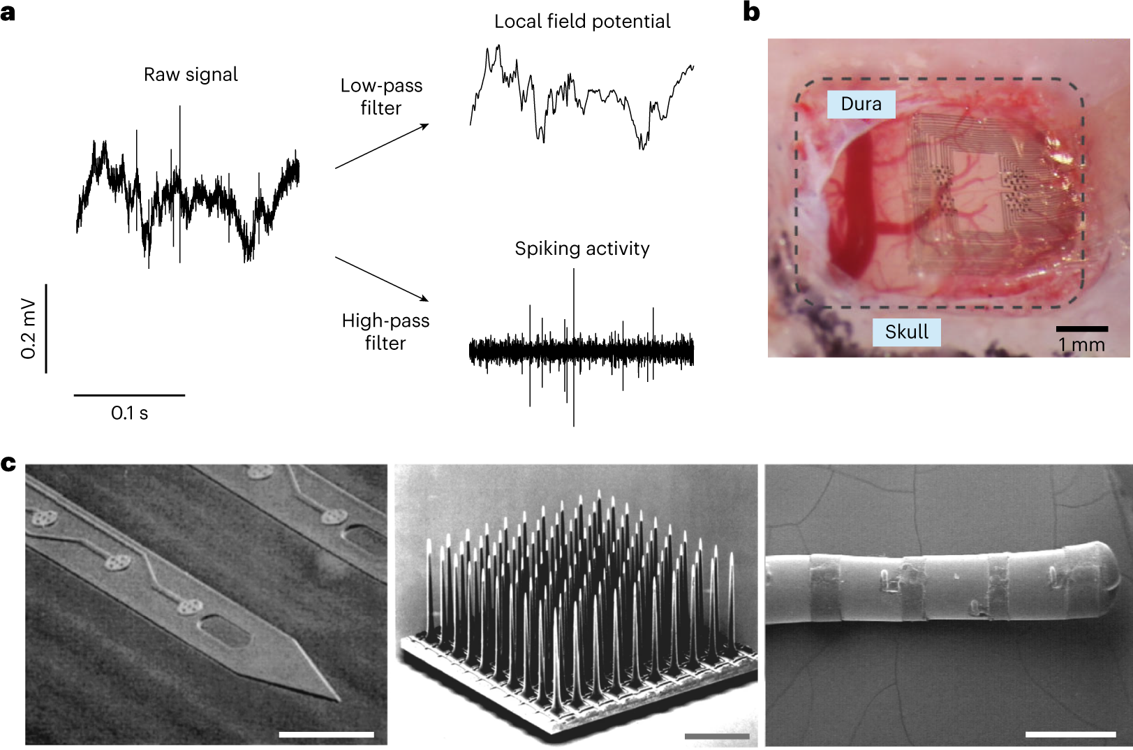 Translational opportunities and challenges of invasive electrodes for  neural interfaces | Nature Biomedical Engineering