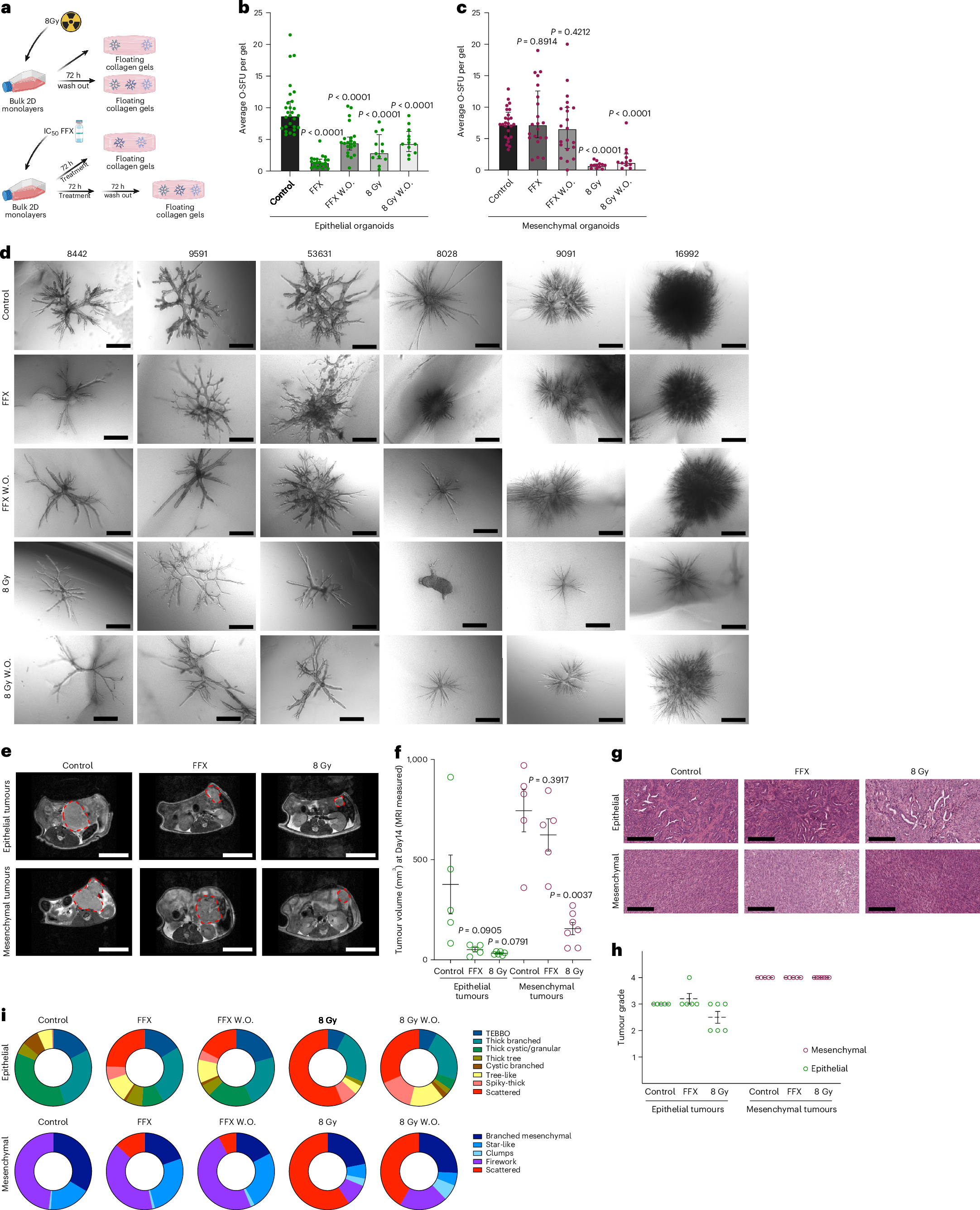 Fig. 6: Defining PDAC subtype and organoid phenotype-specific vulnerabilities to radio- and chemotherapy.