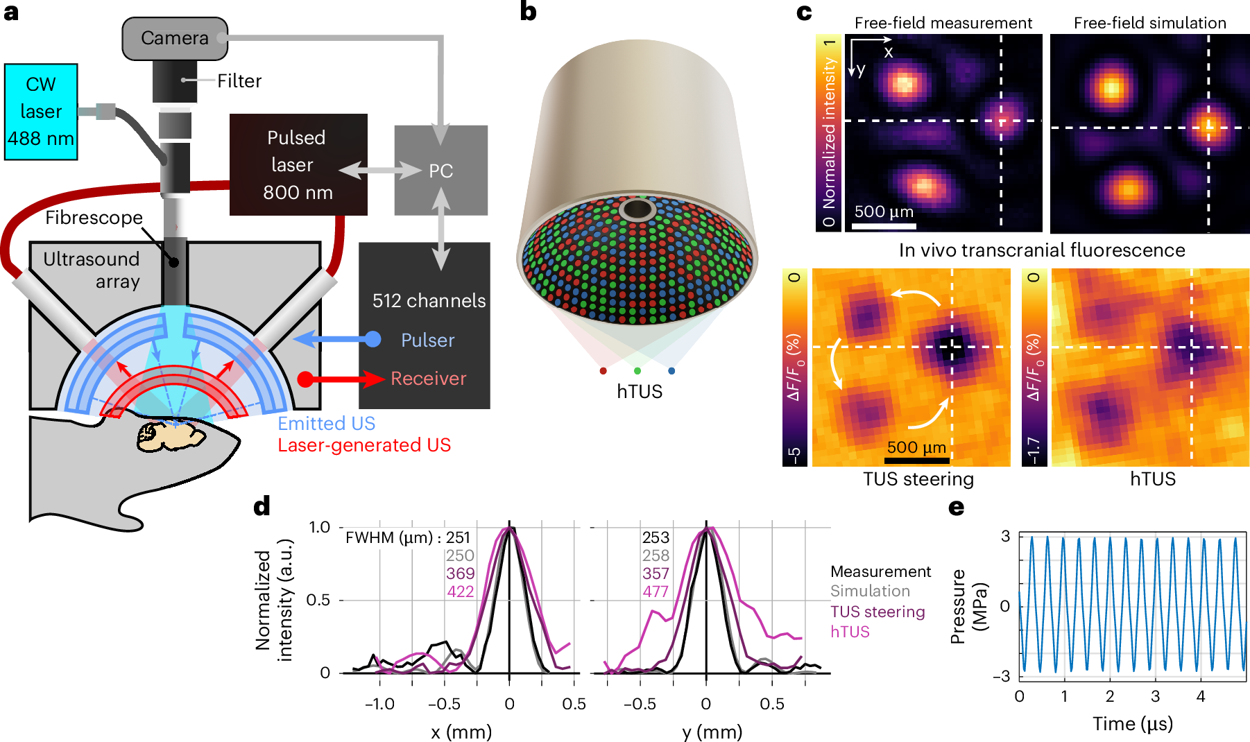 Fig. 1: Noninvasive, precise and highly controllable delivery of ultrasound perturbations to the mouse brain.