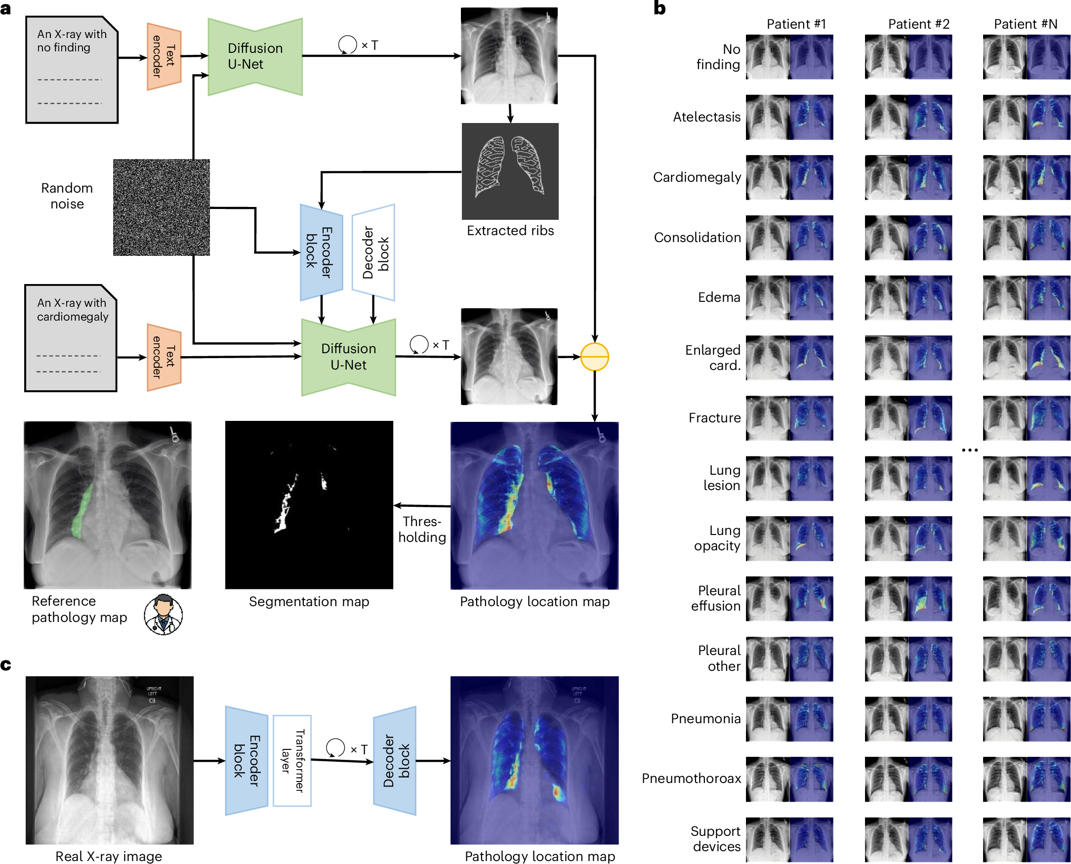 A generative model uses healthy and diseased image pairs for pixel-level  chest X-ray pathology localization | Nature Biomedical Engineering