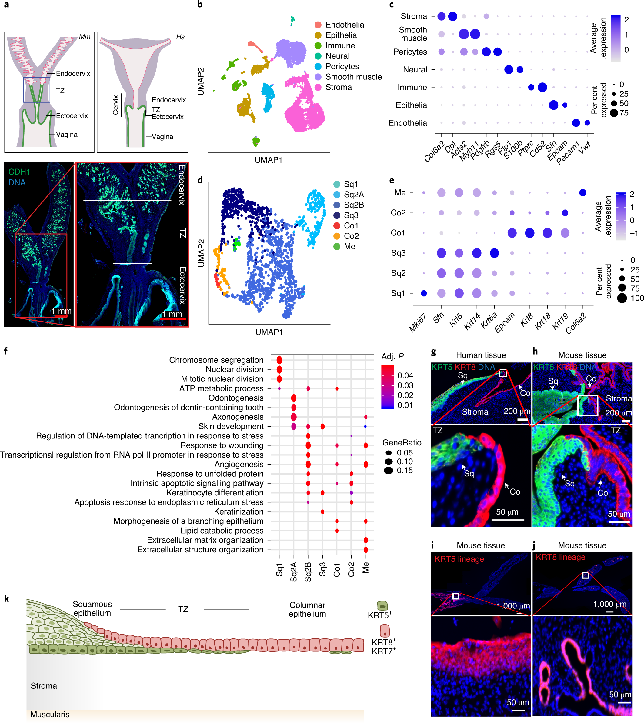 Opposing Wnt signals regulate cervical squamocolumnar homeostasis and  emergence of metaplasia | Nature Cell Biology