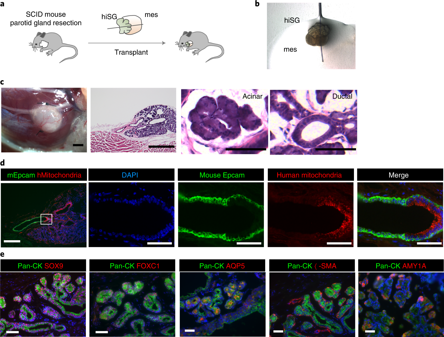 Fig. 3: Orthotopic transplantation of human salivary gland organoids.