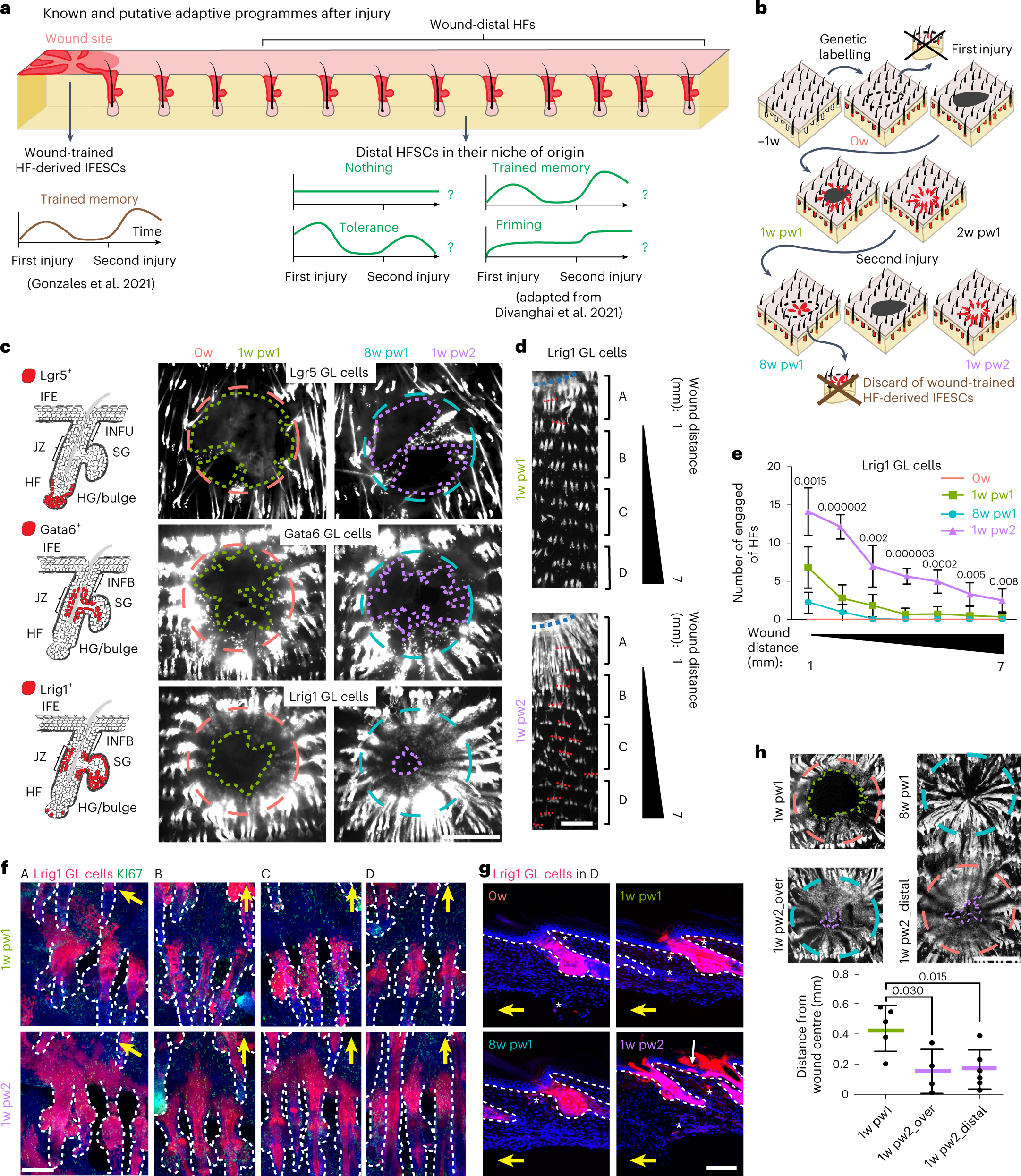 Tissue memory relies on stem cell priming in distal undamaged areas |  Nature Cell Biology