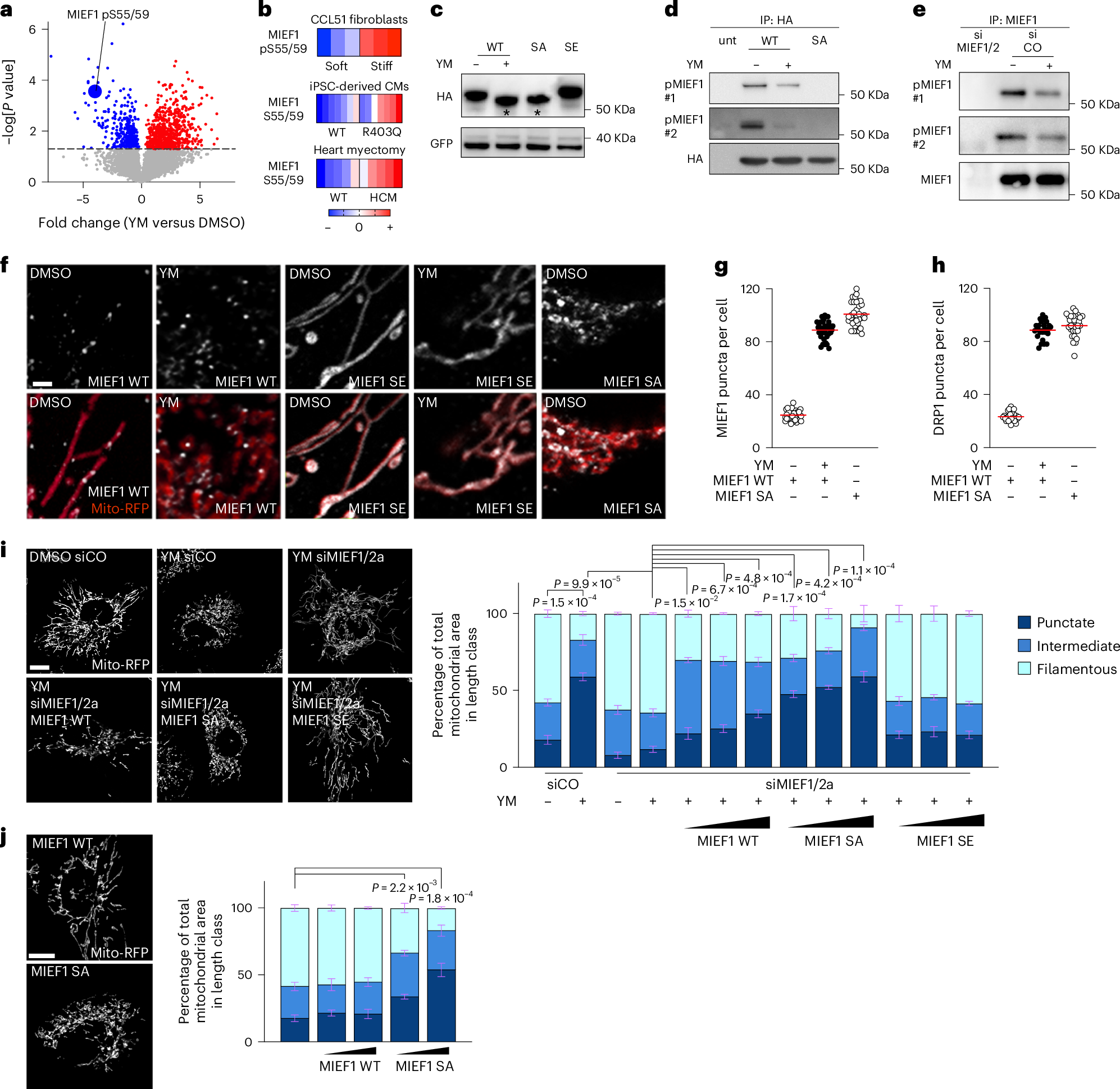 Fig. 7: Actomyosin tension inhibits fission by promoting MIEF1
                                    phosphorylation.