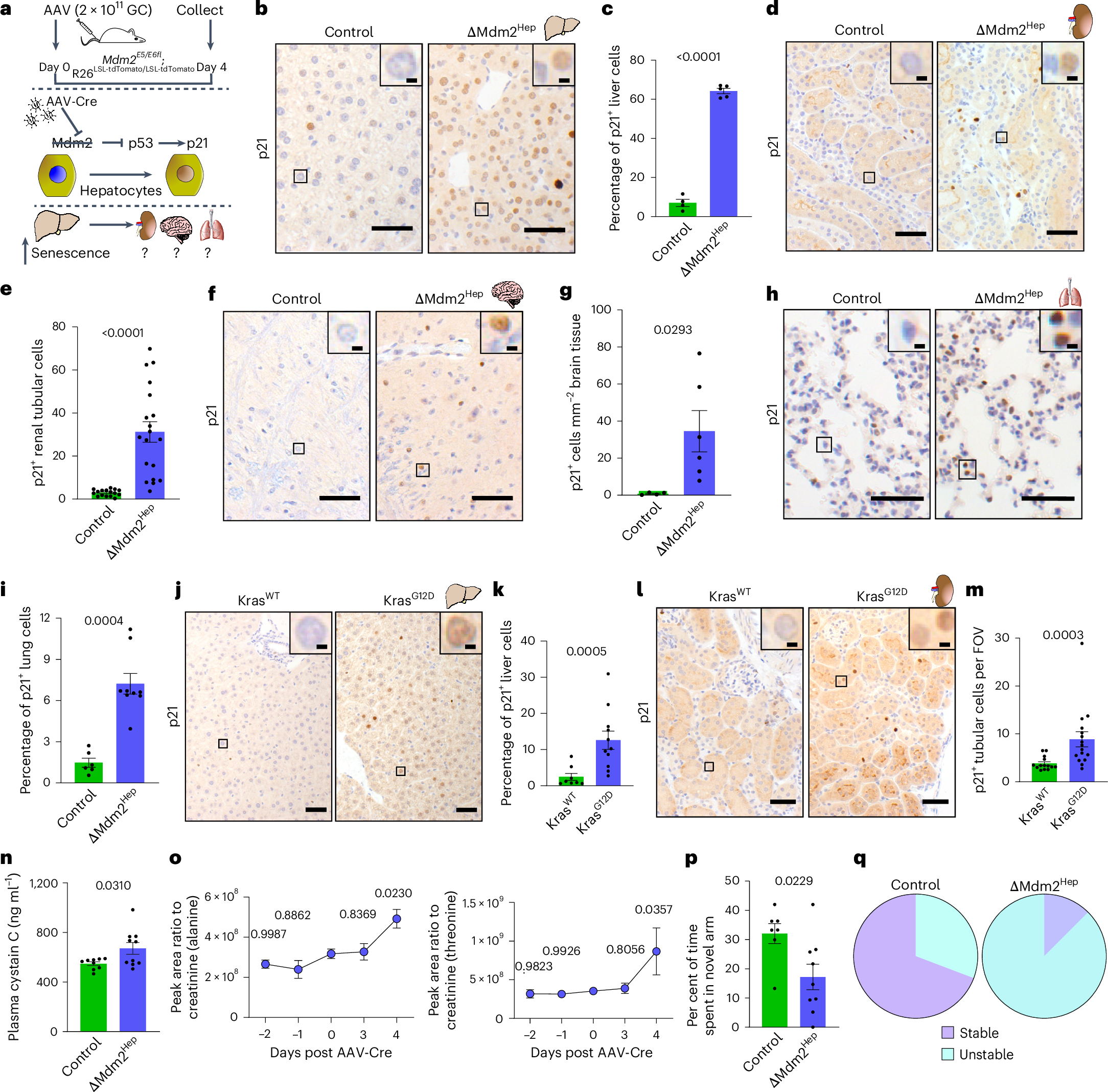 Fig. 1: Hepatocellular senescence results in senescence and dysfunction in other organs.