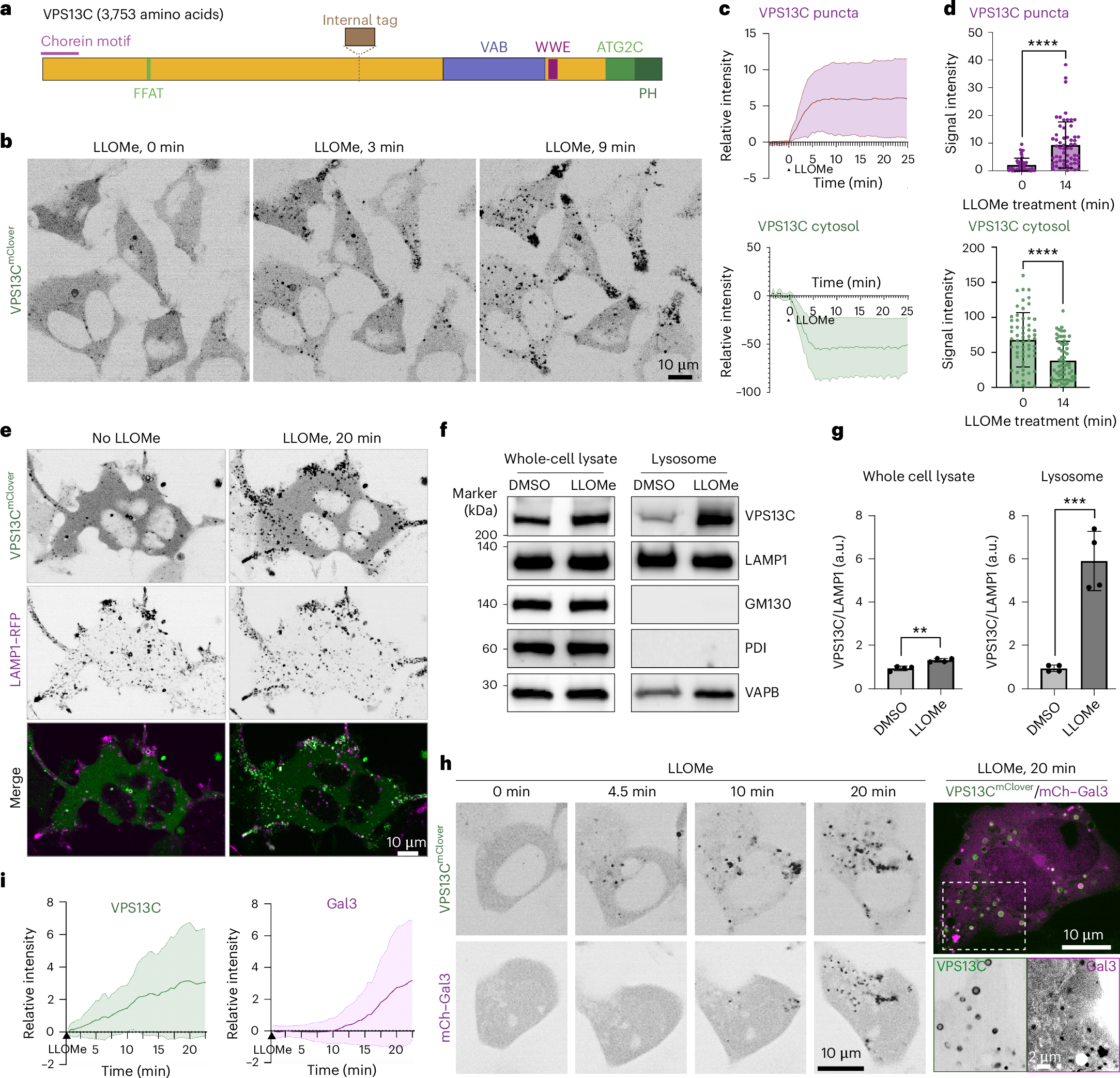 細胞の「ゴミ箱」機能障害がパーキンソン病に関与か(Damaged Cell ‘Trash Cans’ May Contribute to Parkinson’s Disease)