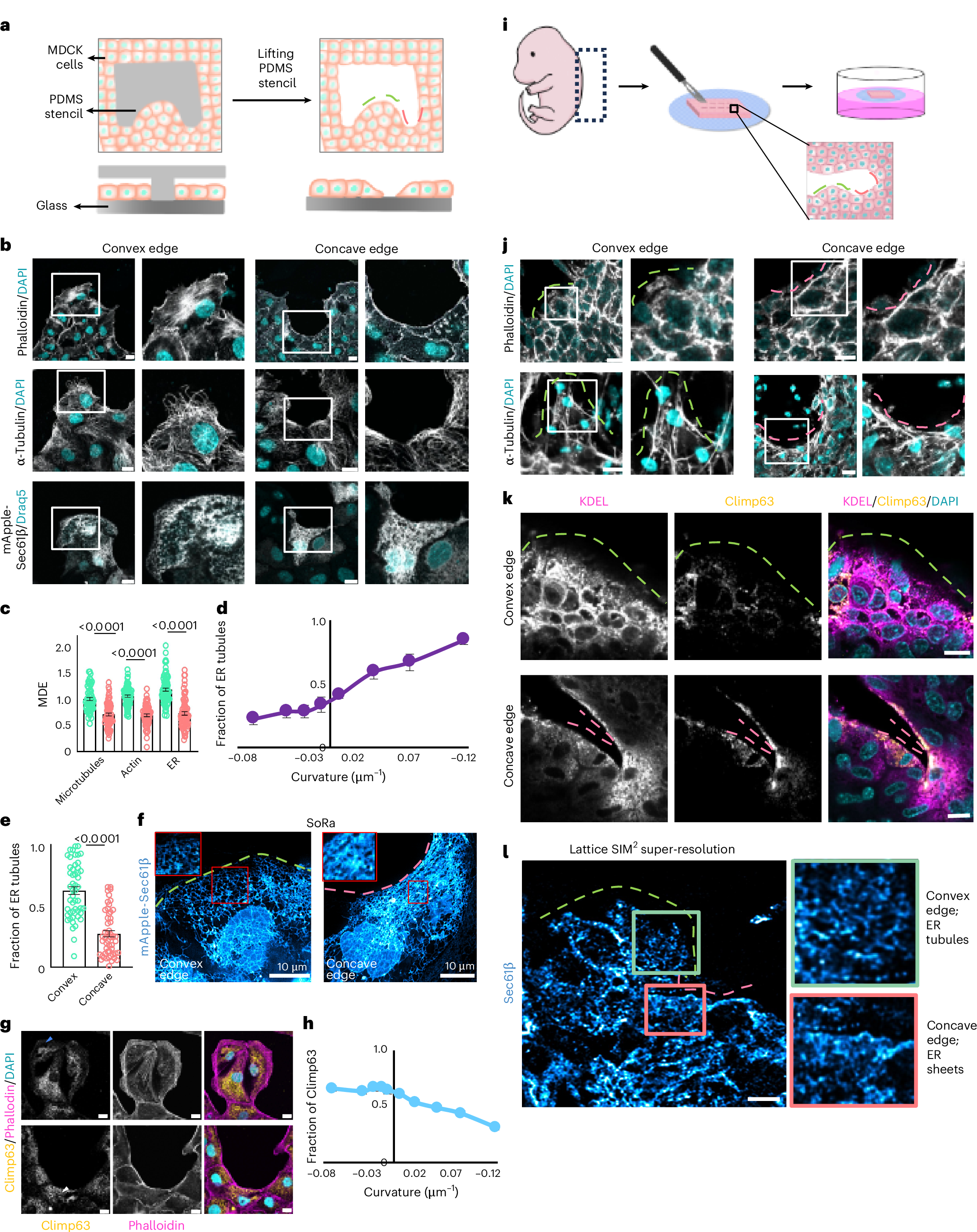 創傷治癒における細胞の形状変化メカニズムを解明(Body’s cells change shape to deal with wounds)
