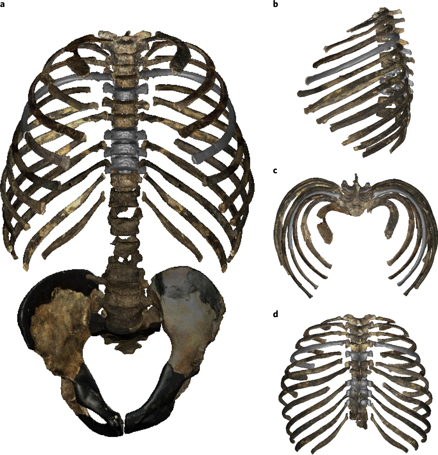 Rib cage anatomy in Homo erectus suggests a recent evolutionary origin of  modern human body shape | Nature Ecology & Evolution