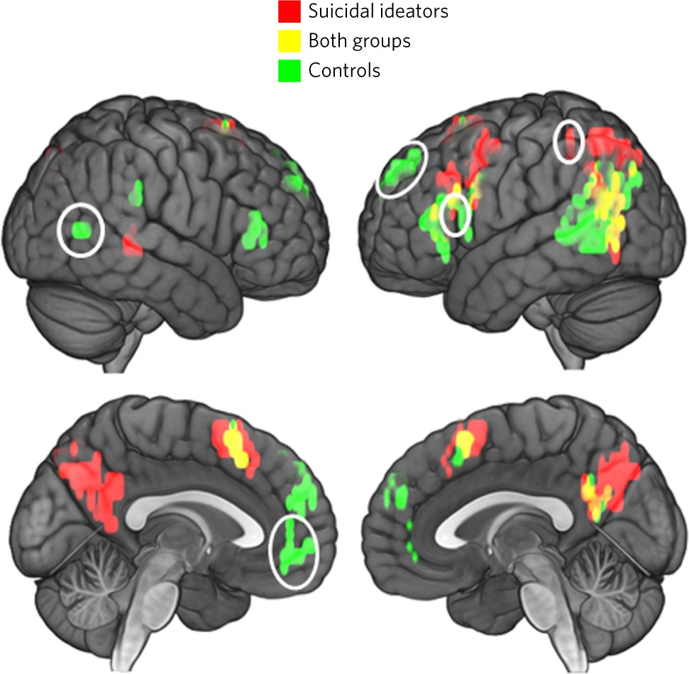 Risultati immagini per suicide link brain