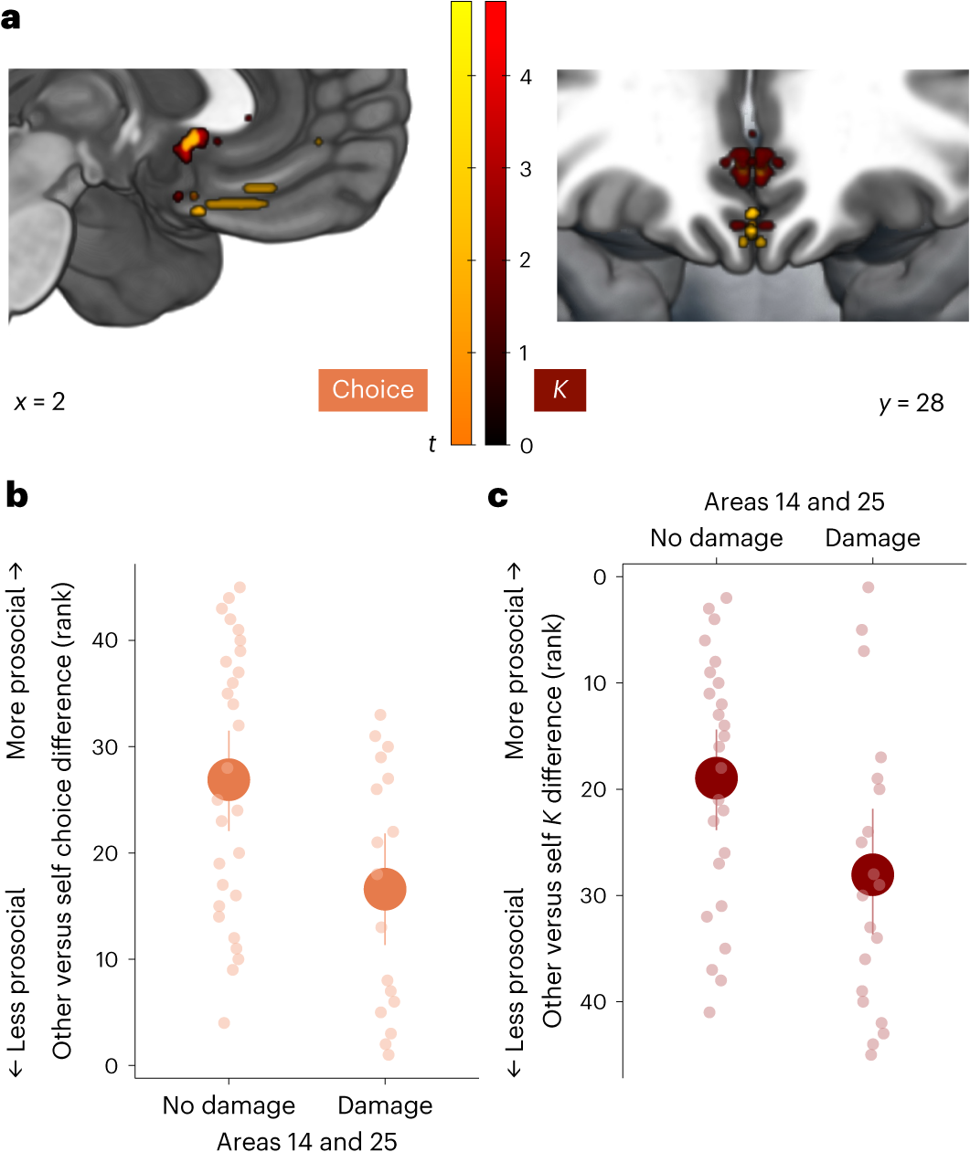 Fig. 6: Damage to medial portions of vmPFC specifically is associated with reduced prosocial behaviour.