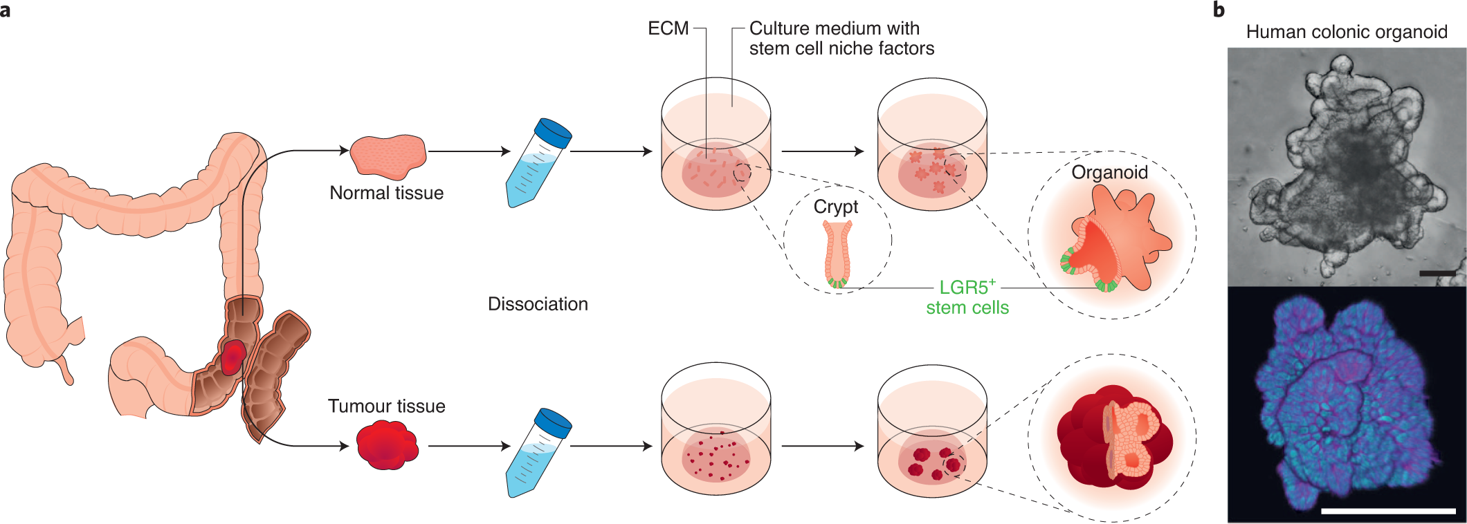 Somatic cell-derived organoids as prototypes of human epithelial tissues  and diseases | Nature Materials