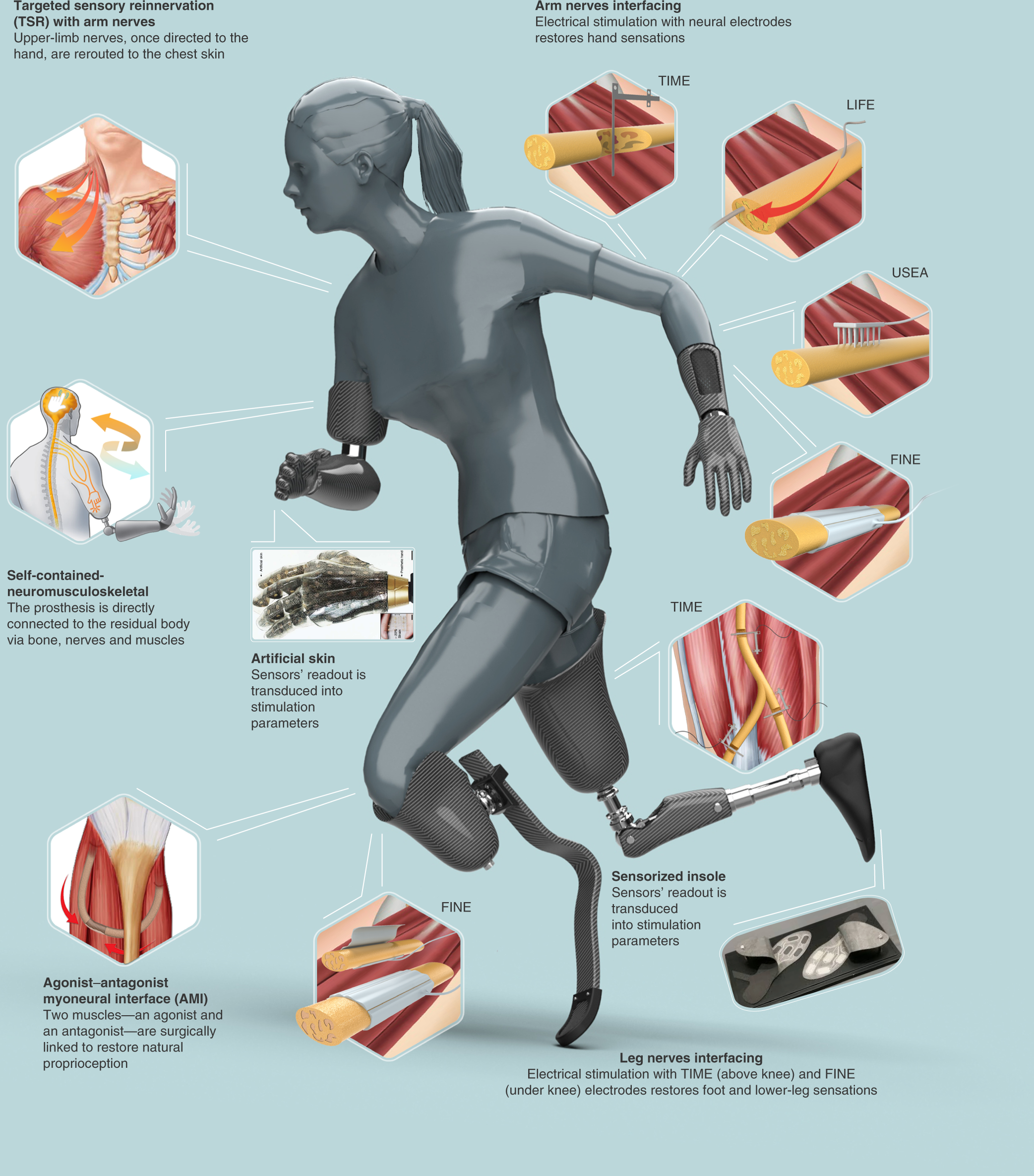 Sensory feedback for limb prostheses in amputees | Nature Materials