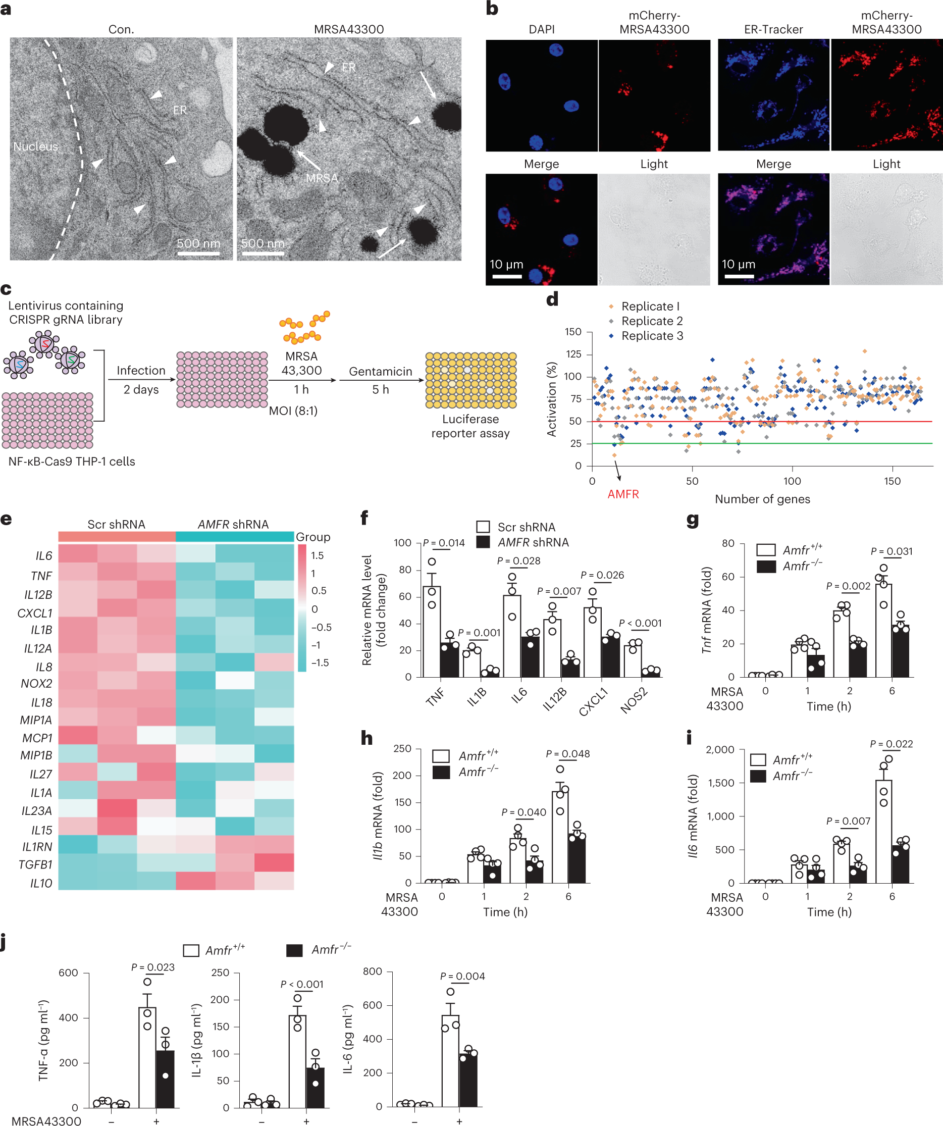 Staphylococcus aureus Orchestrates Type 2 Airway Diseases: Trends in  Molecular Medicine