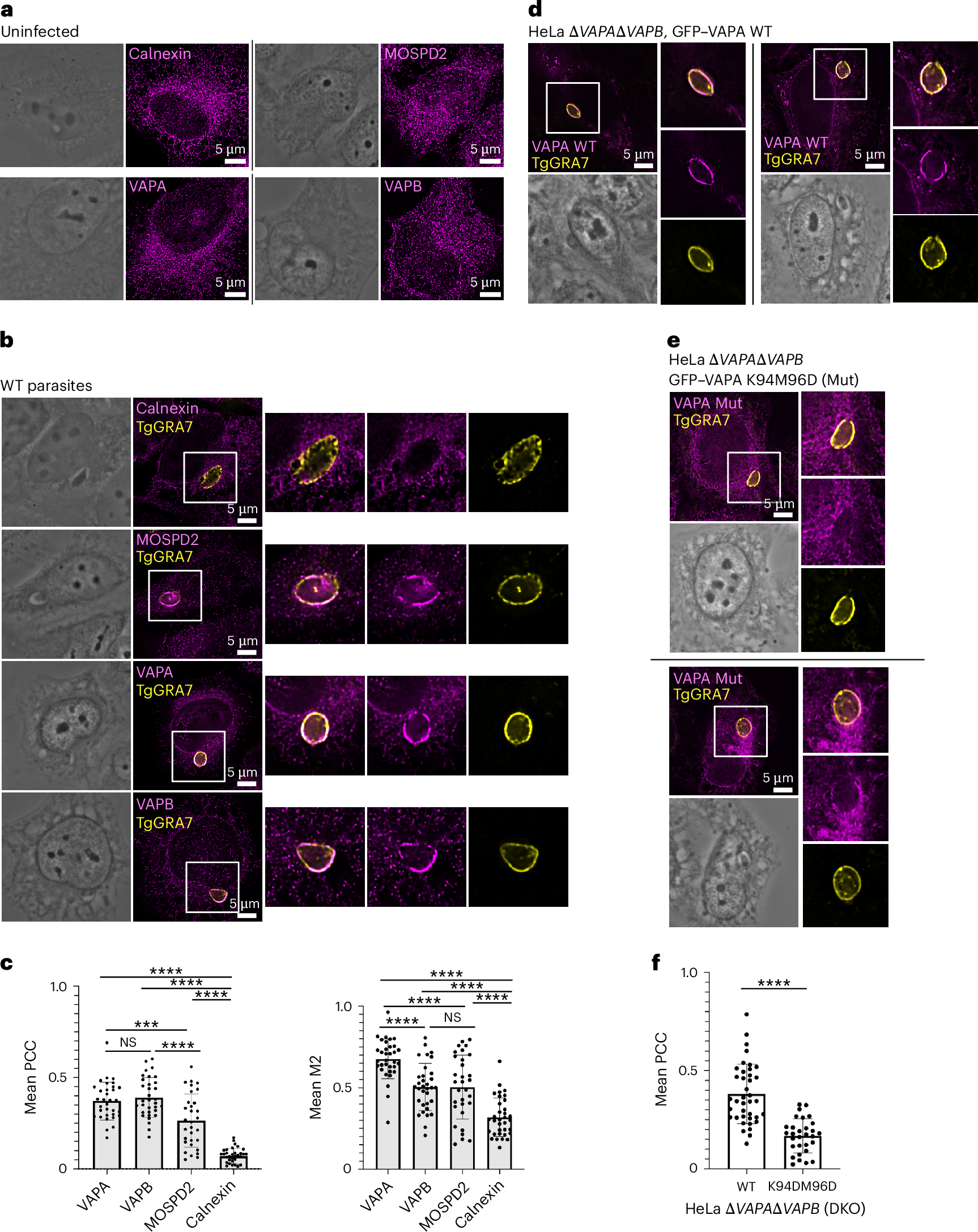 Toxoplasma gondii VIP1 mediates parasitophorous vacuole–host endoplasmic  reticulum interactions to facilitate parasite development