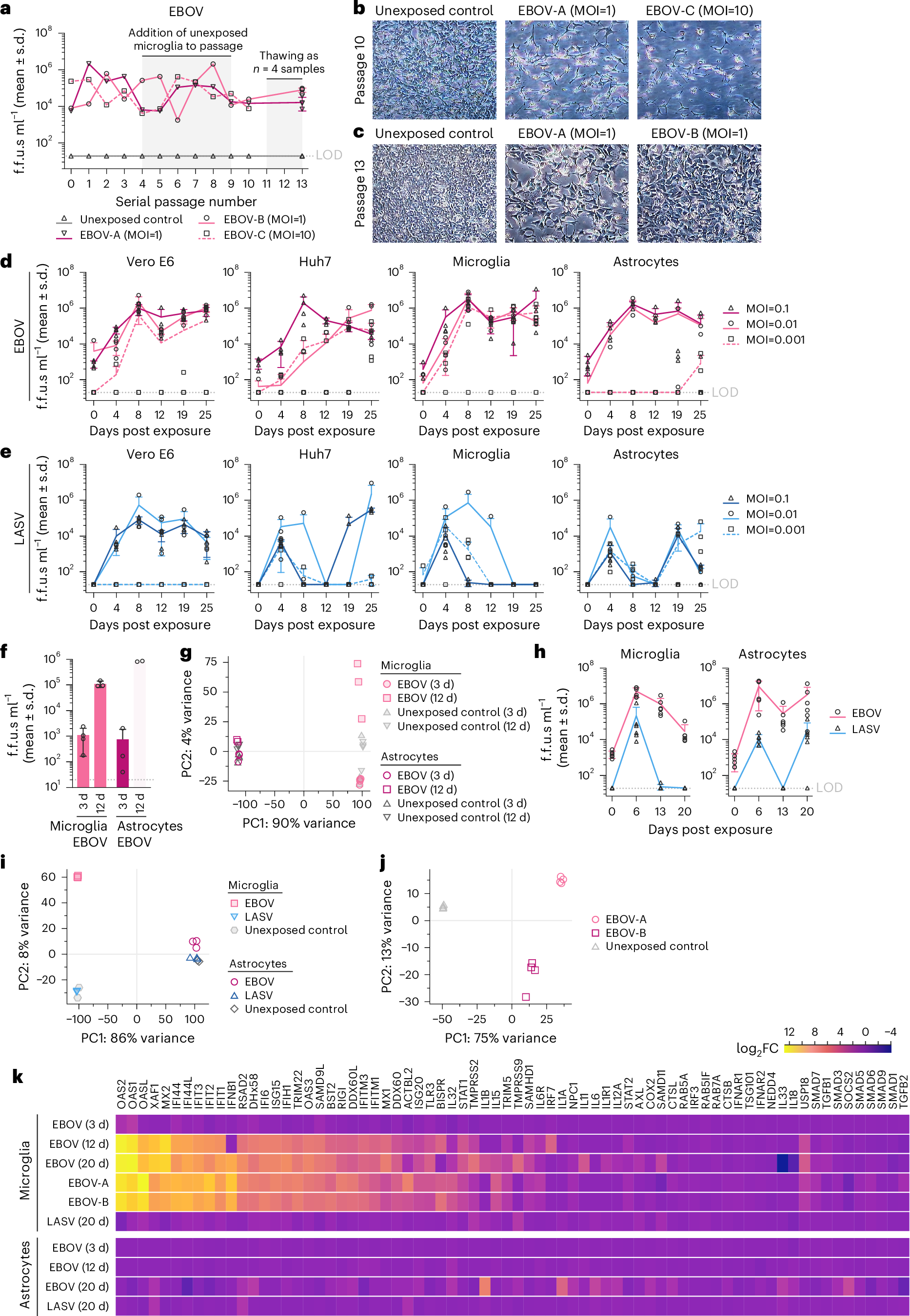 エボラウイルスが中枢神経系に潜伏することを発見 (Ebola Virus Hides in the Central Nervous System, According to New Research)