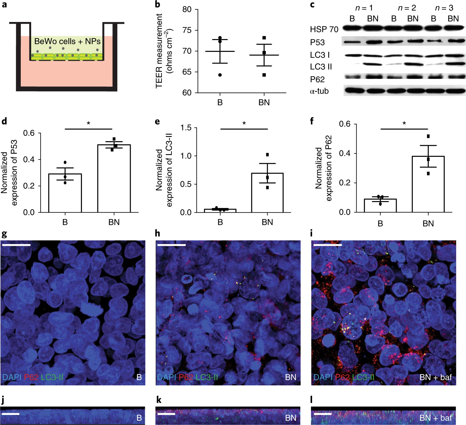 Nanoparticle-induced neuronal toxicity across placental barriers is  mediated by autophagy and dependent on astrocytes | Nature Nanotechnology