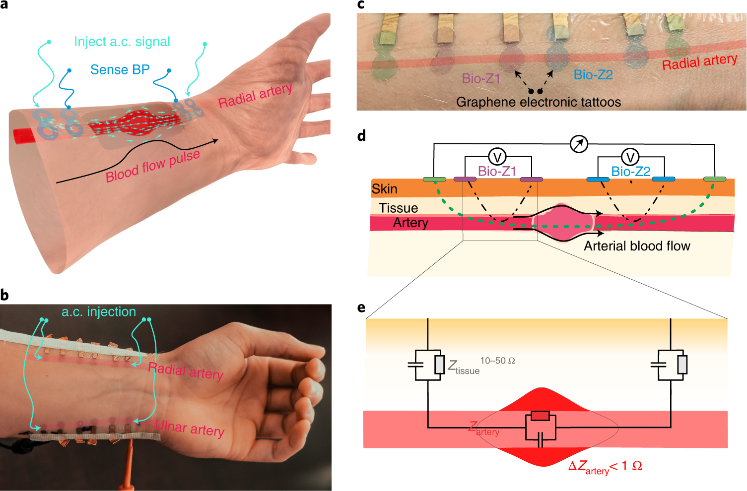 Continuous cuffless monitoring of arterial blood pressure via graphene  bioimpedance tattoos | Nature Nanotechnology