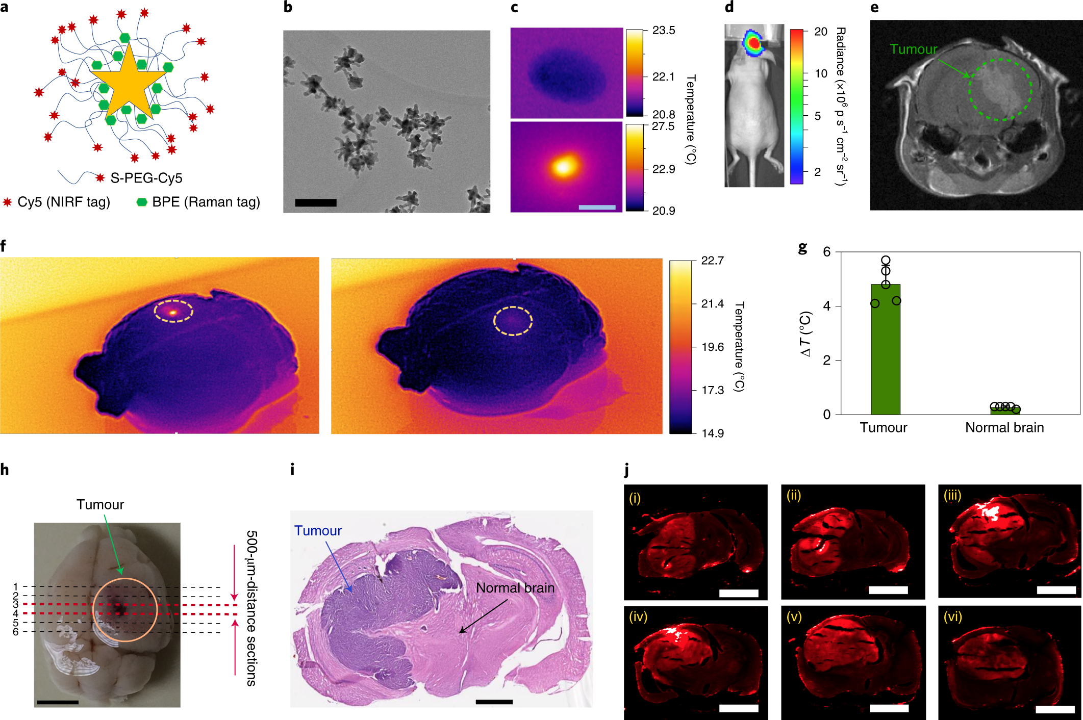 Remotely controlled near-infrared-triggered photothermal treatment of brain  tumours in freely behaving mice using gold nanostar﻿s | Nature  Nanotechnology